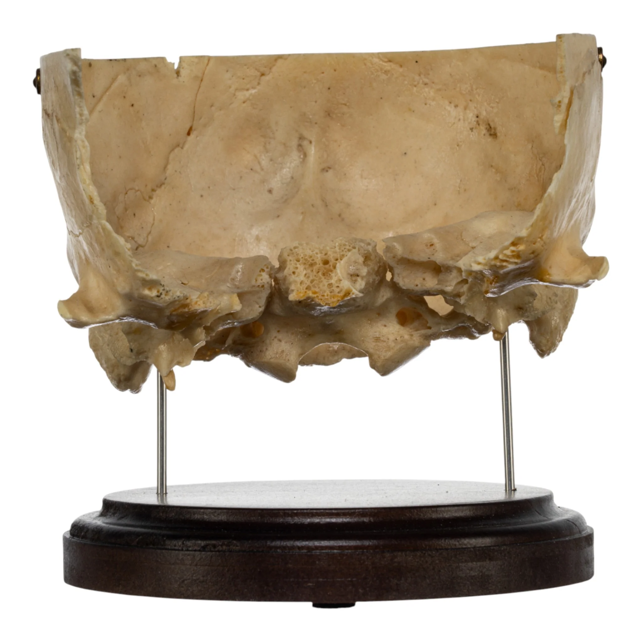 Real Human Partial Skull on Stand - Image 3