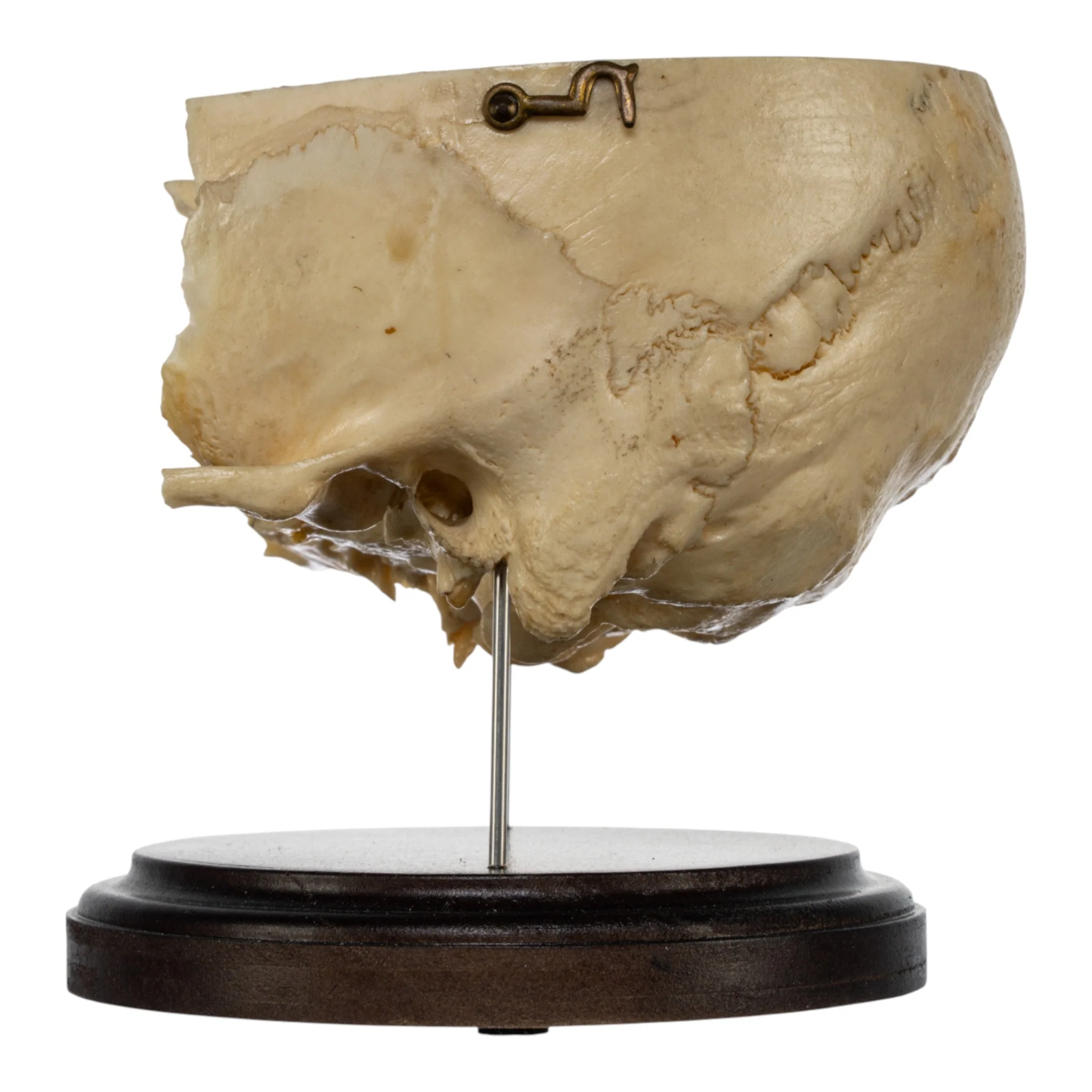 Real Human Partial Skull on Stand - Image 4