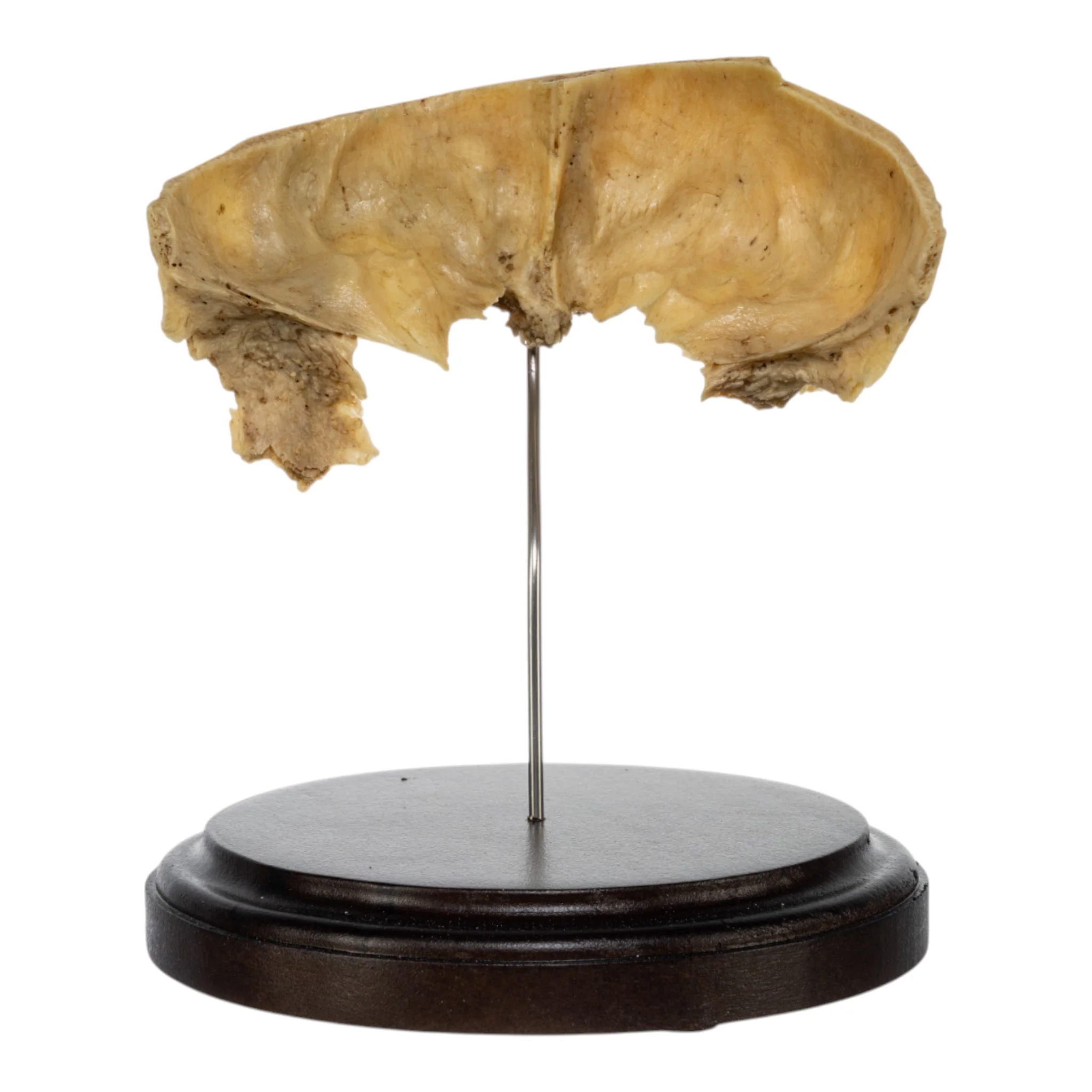Real Human Partial Frontal Bone on Stand - Image 2