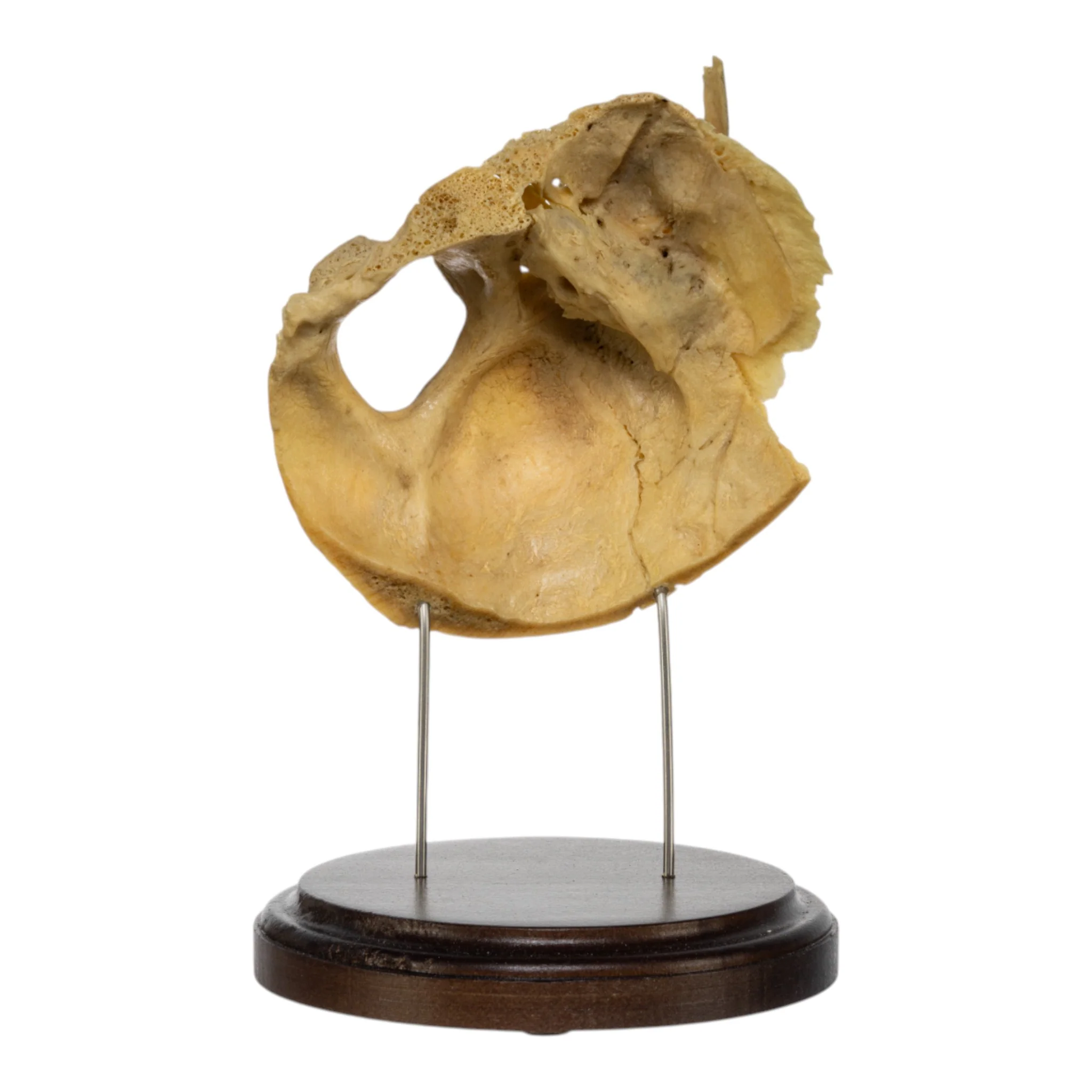 Real Human Partial Skull on Stand - Image 2