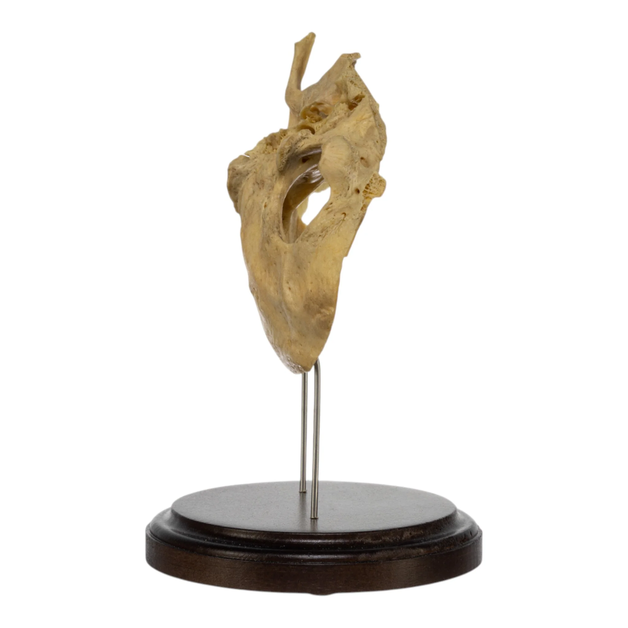 Real Human Partial Skull on Stand - Image 3