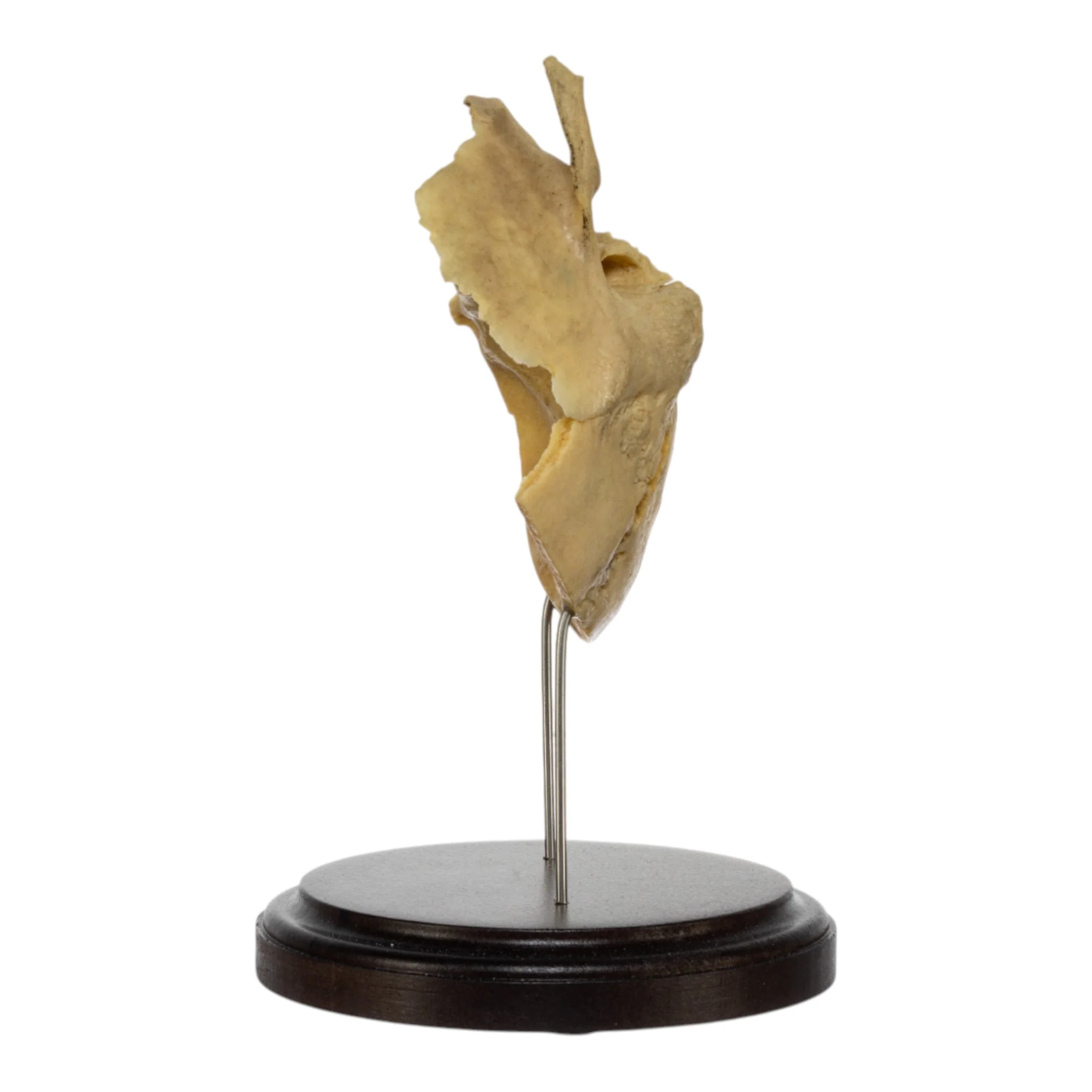 Real Human Partial Skull on Stand - Image 4