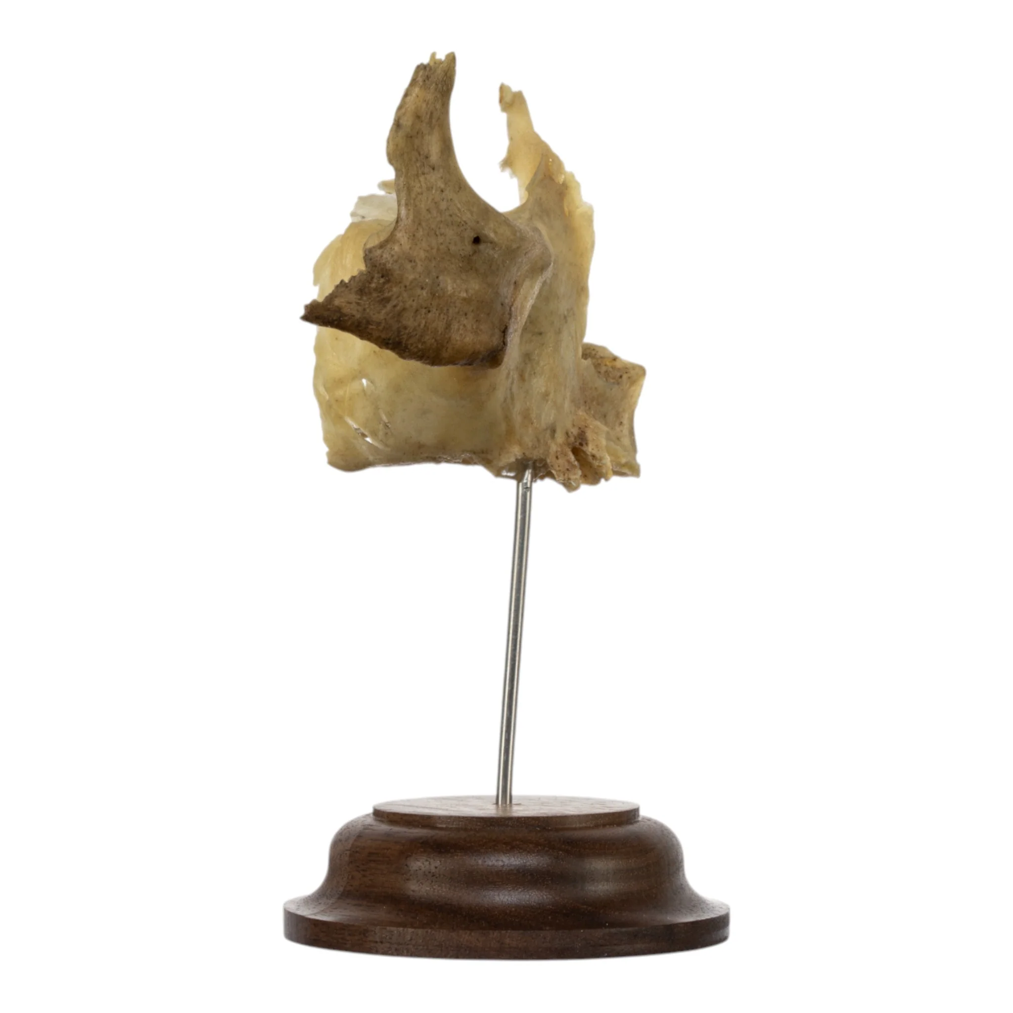 Real Human Partial Skull on Stand - Image 4