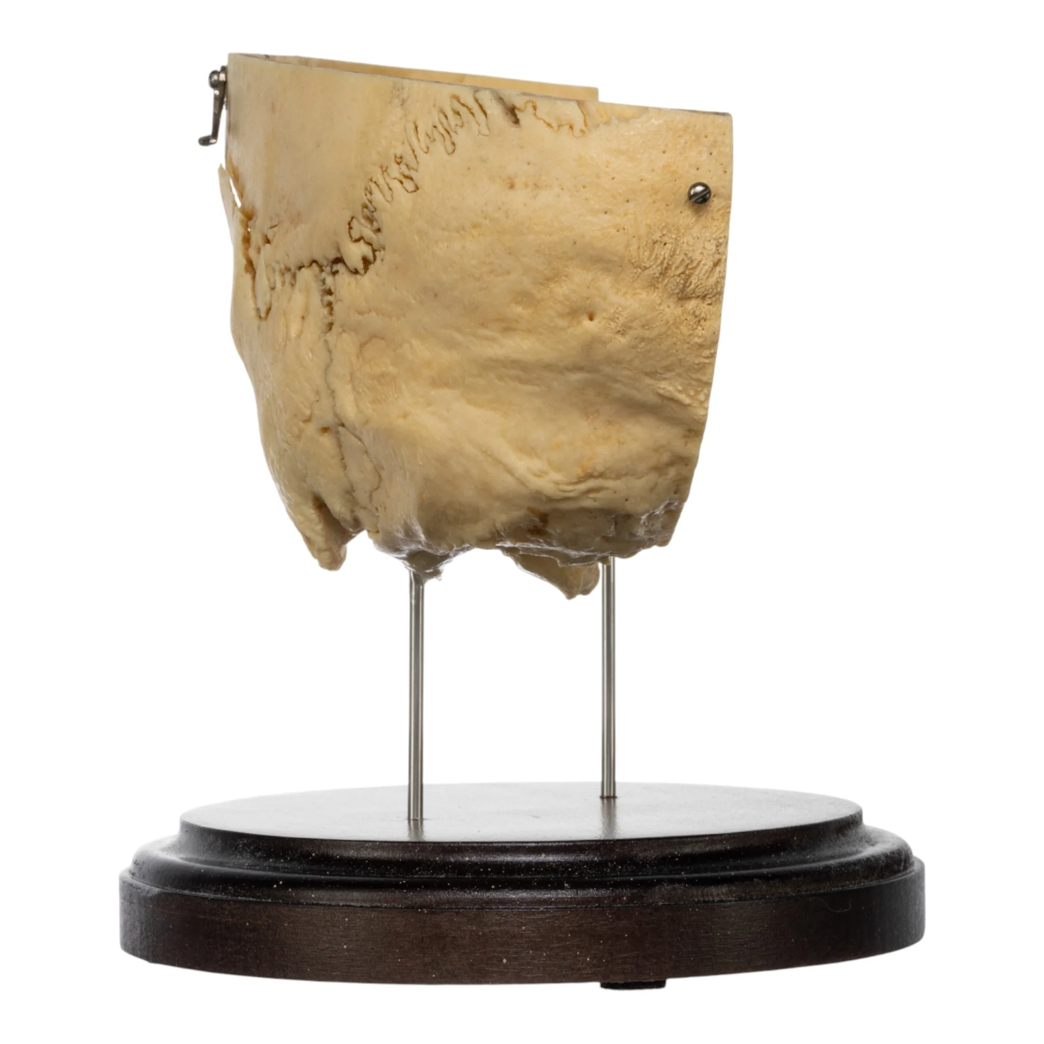 Real Human Partial Skull on Stand - Image 2