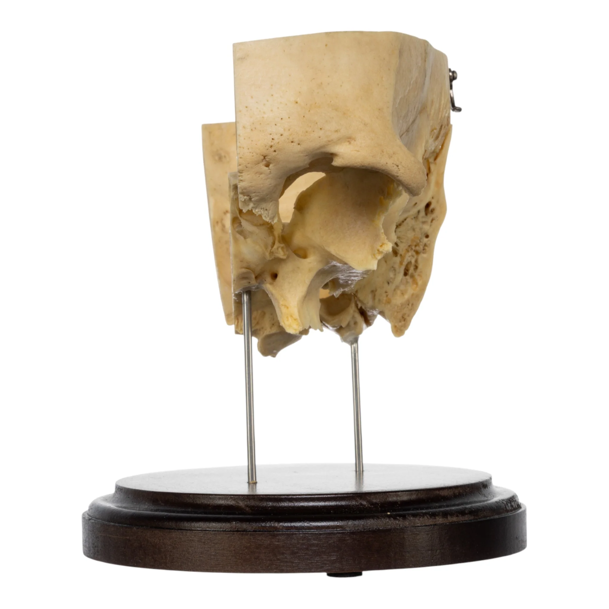 Real Human Partial Skull on Stand - Image 4