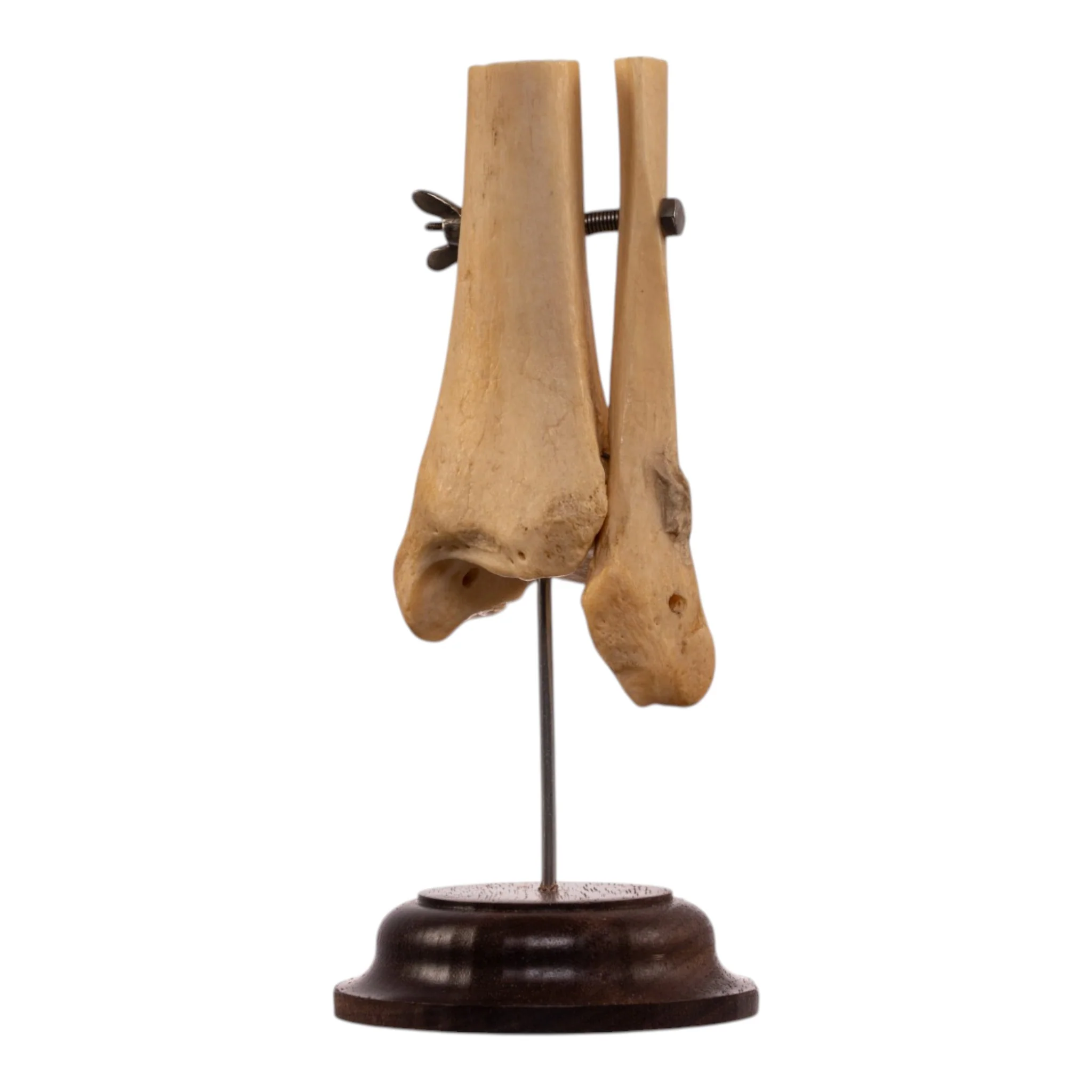 Real Human Partial Tibia and Fibula on Stand - Image 2