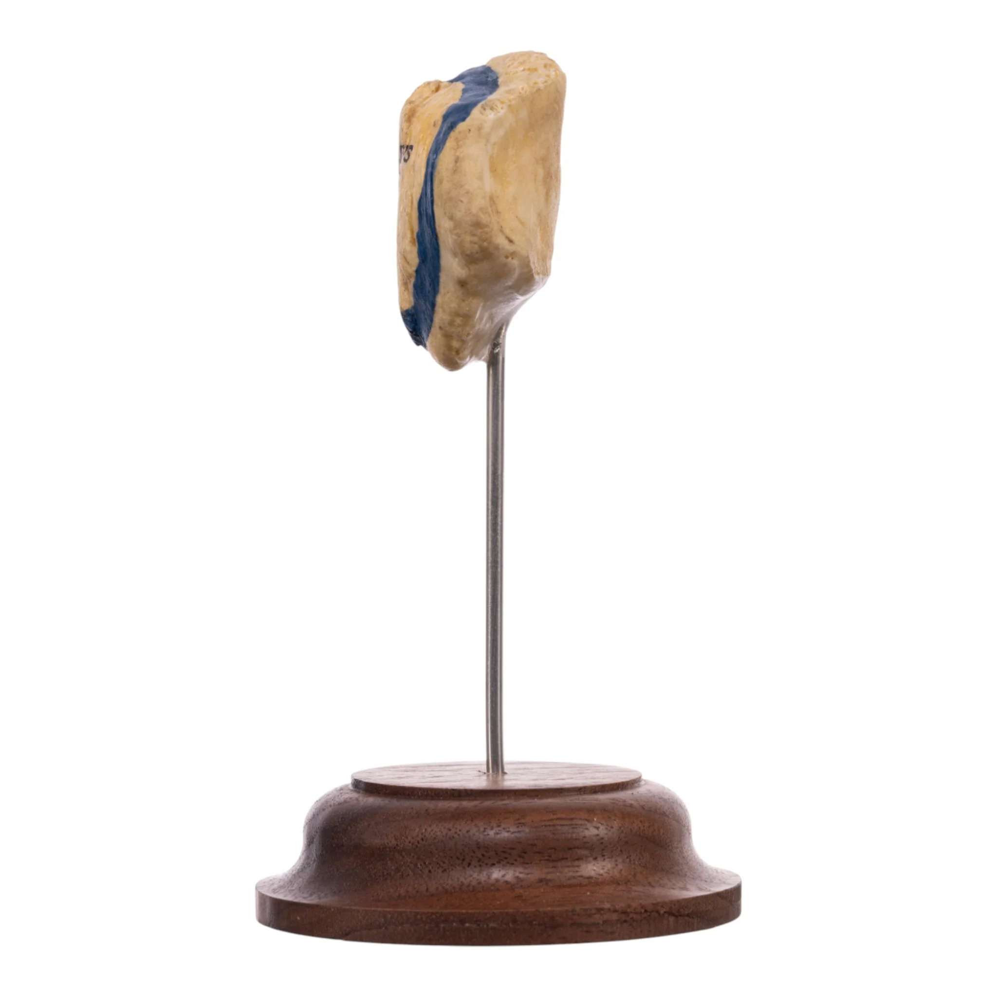 Real Human Patella - On Stand - Image 4