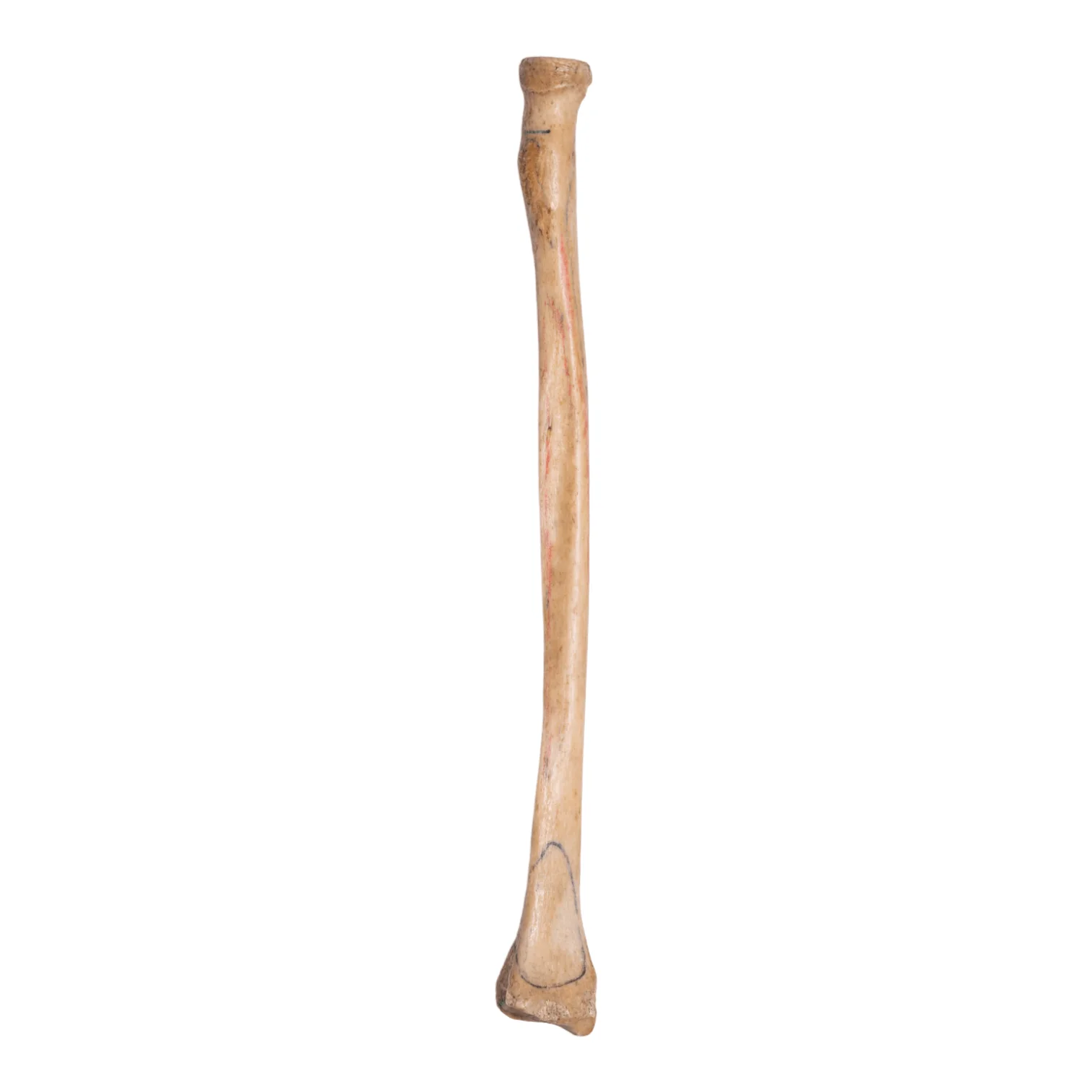 Real Human Radius - Antique - Image 3