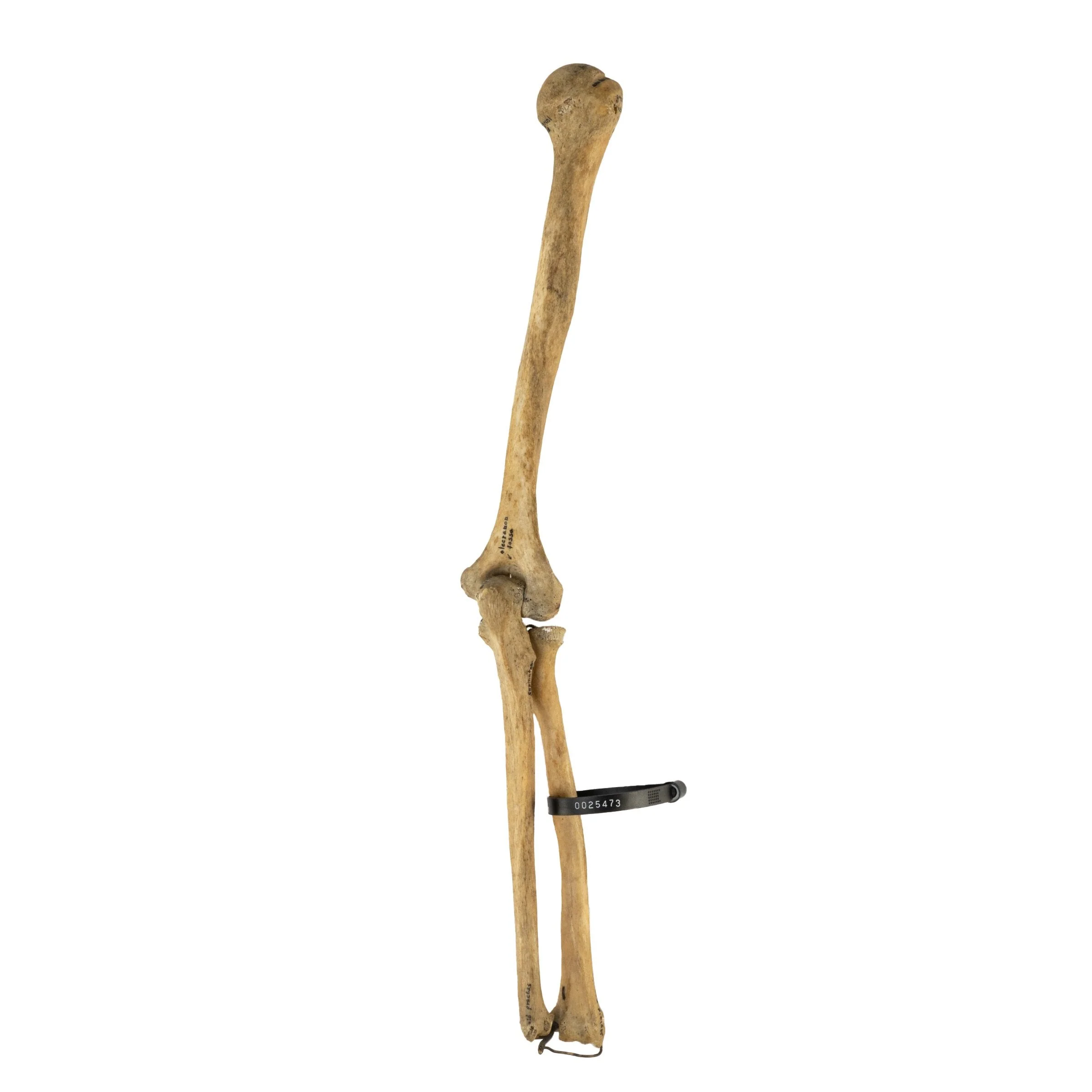 Real Human Humerus, Radius, and Ulna - Image 2