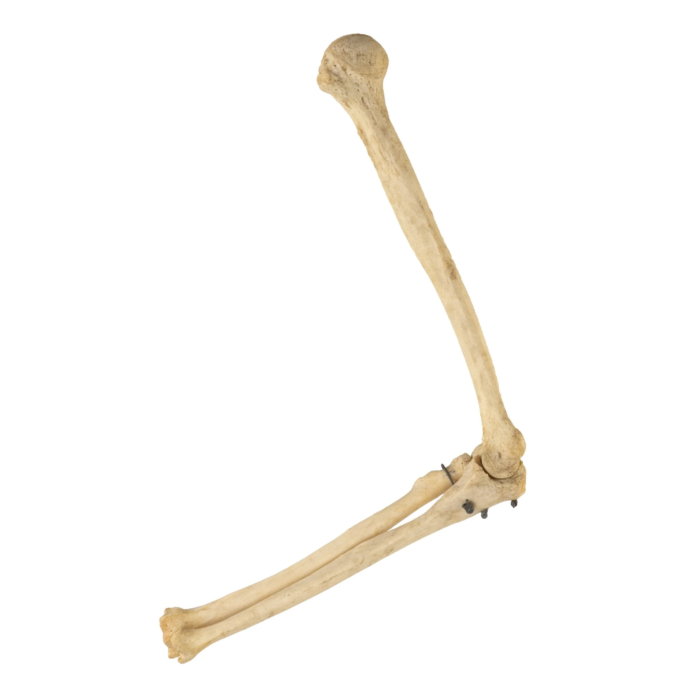 Real Human Humerus, Radius, and Ulna - Image 3