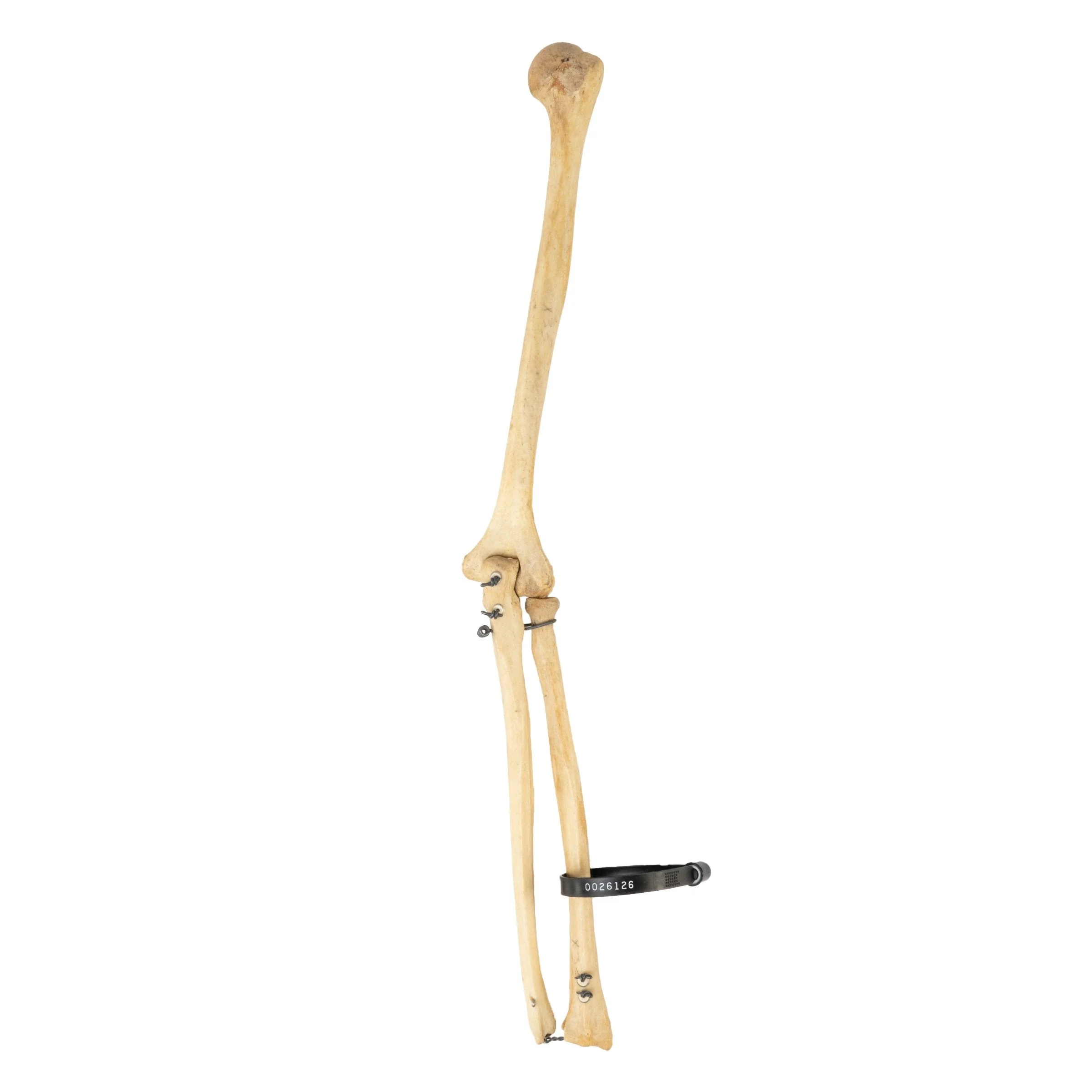 Real Human Humerus, Radius, and Ulna - Image 2
