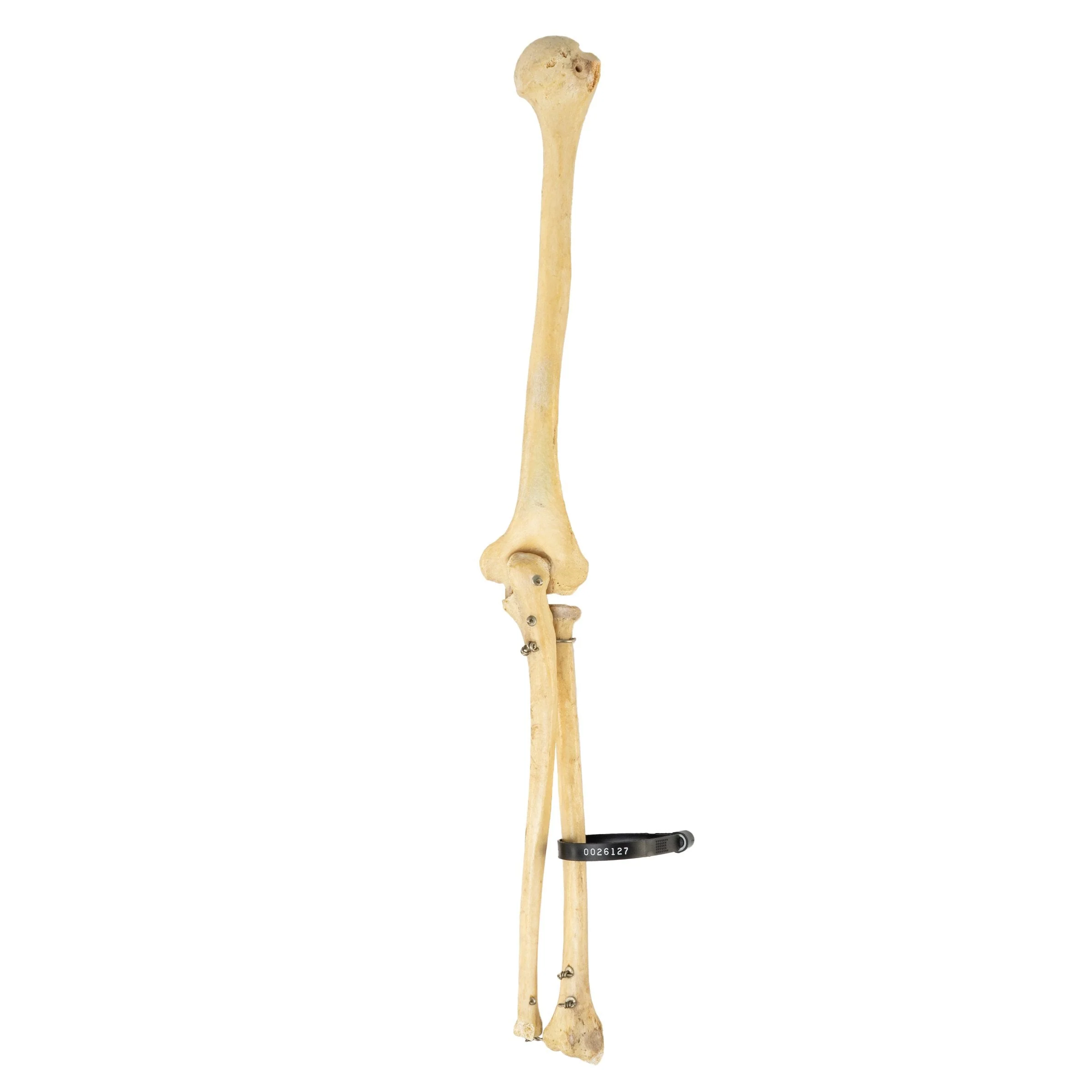 Real Human Humerus, Radius, and Ulna - Image 3