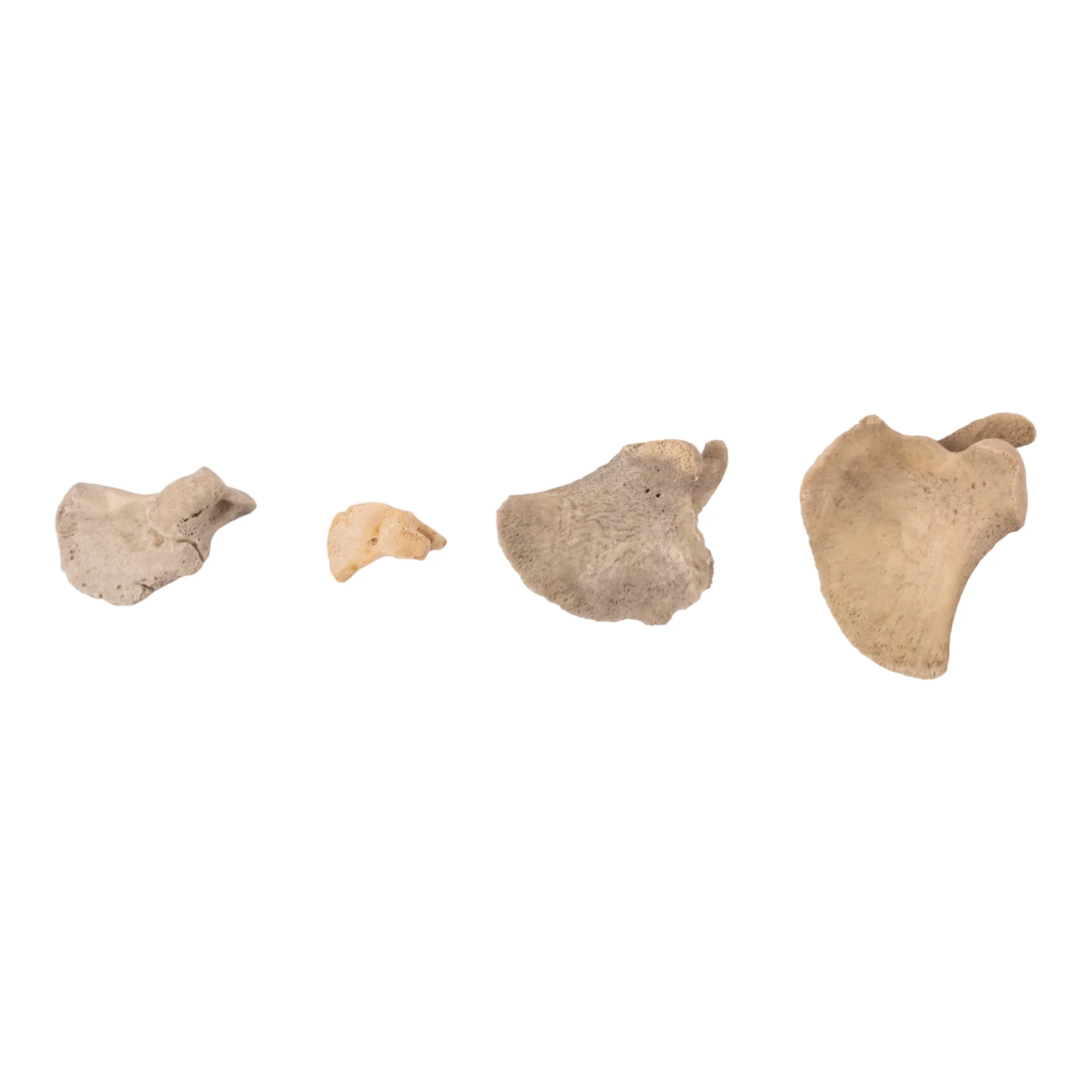 Real Research Quality Human Fetal Scapula - Single - Image 2