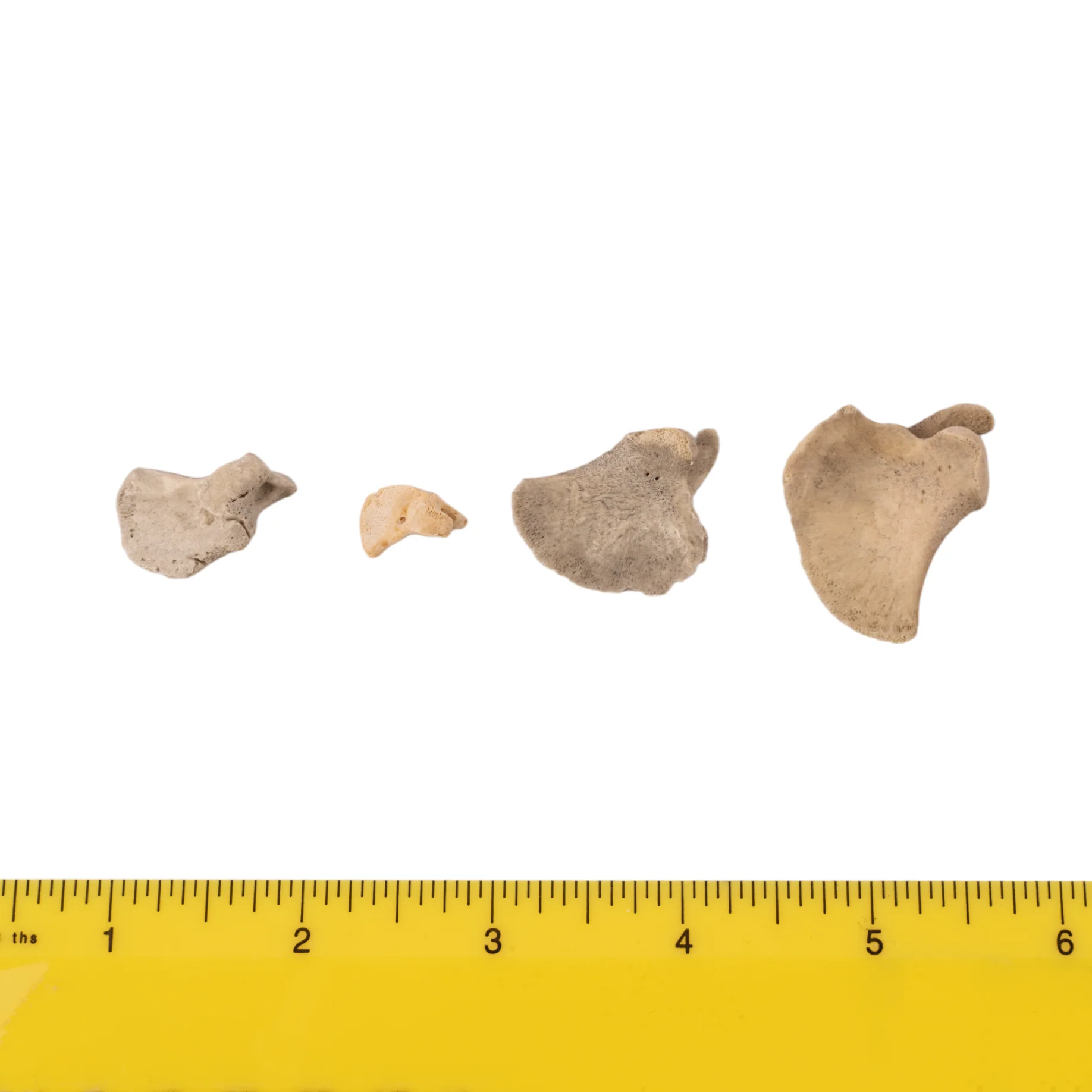 Real Research Quality Human Fetal Scapula - Single - Image 3