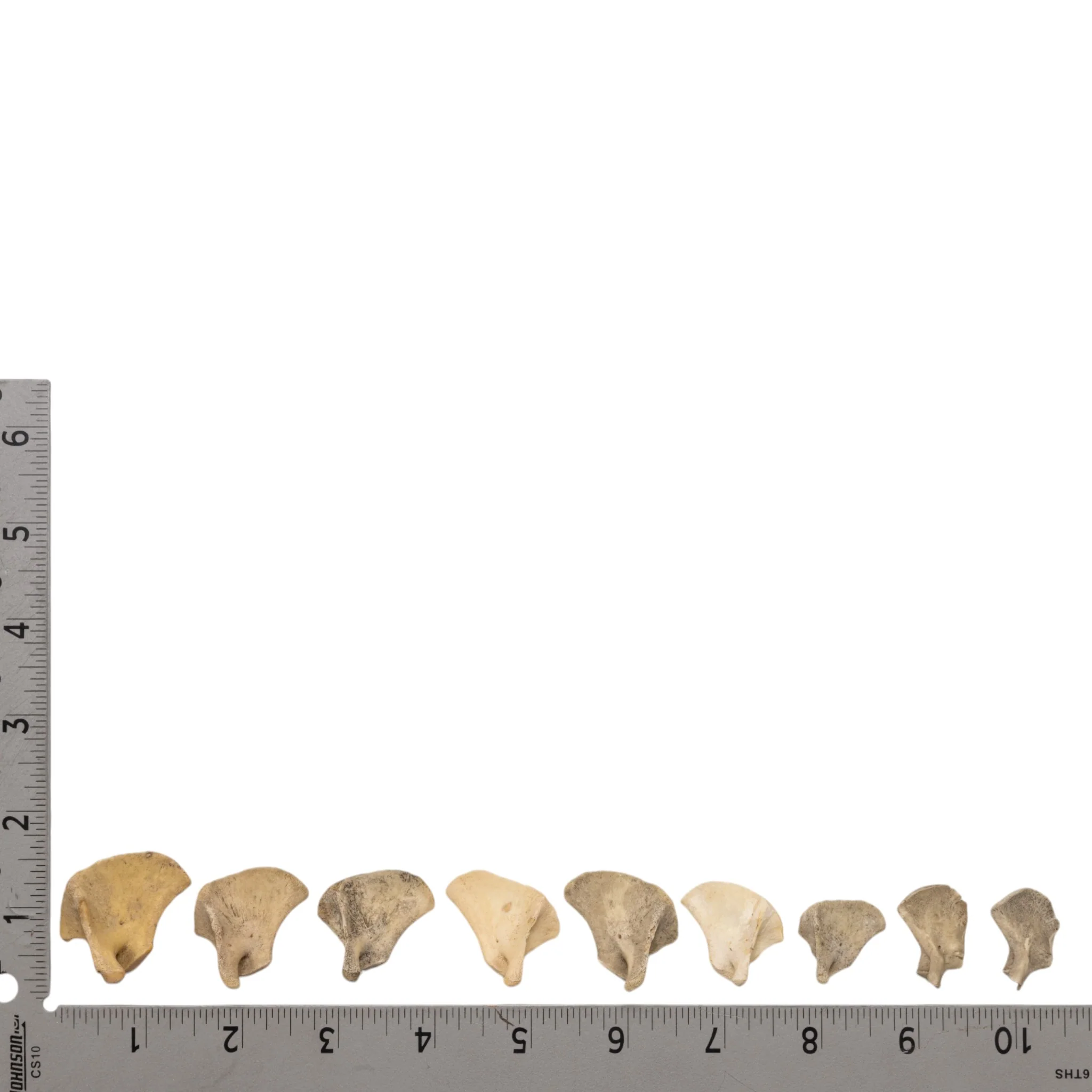 Real Research Quality Human Fetal Scapula - Single - Image 4