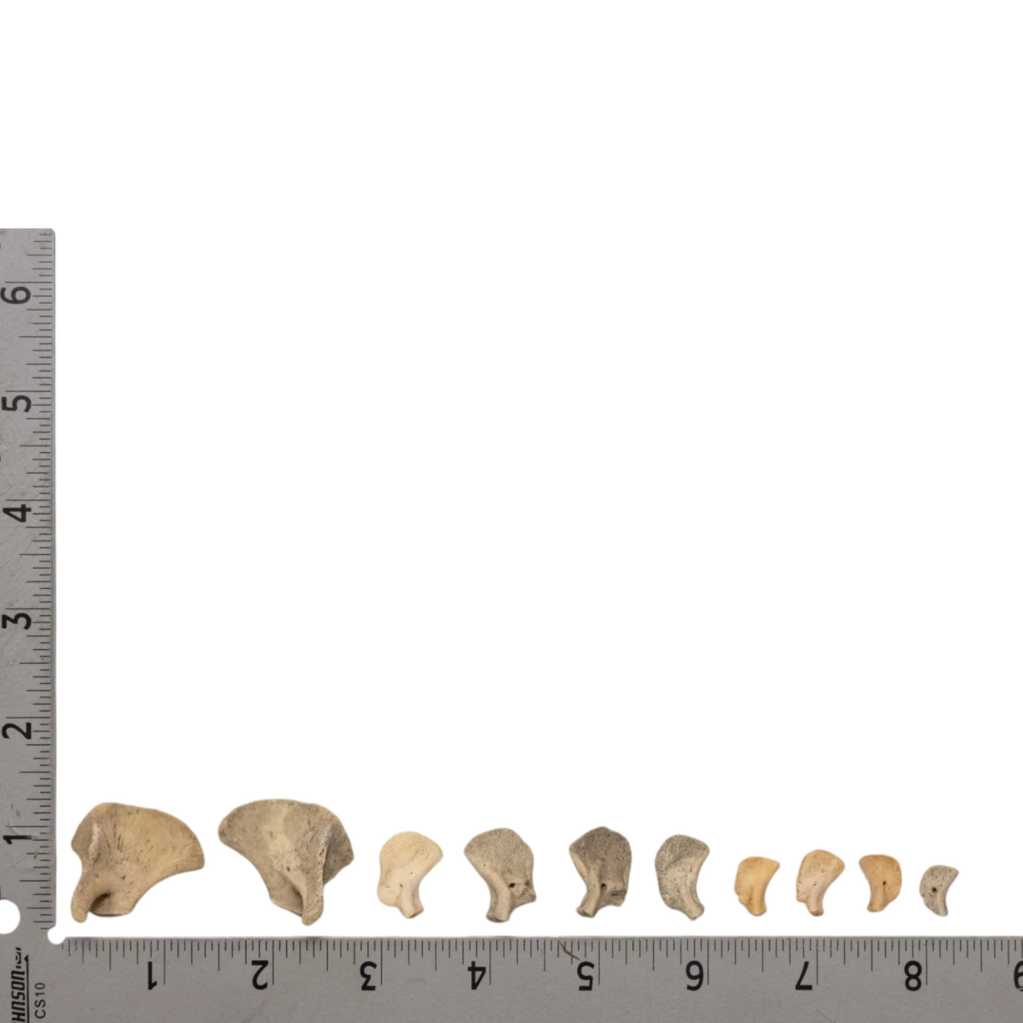 Real Research Quality Human Fetal Scapula - Single - Image 5
