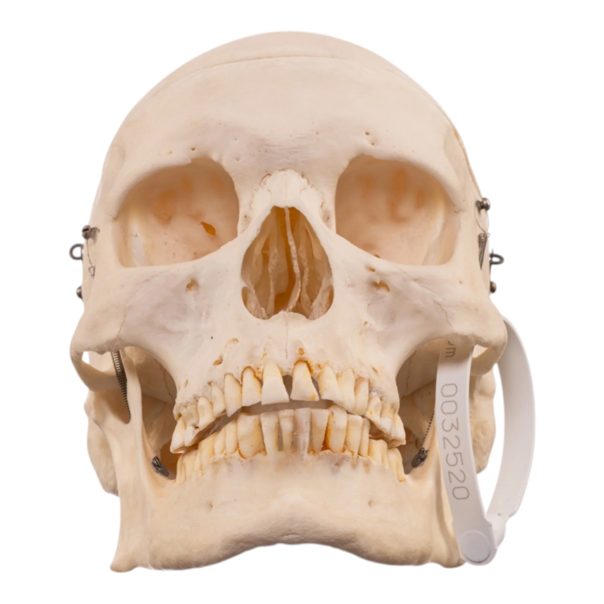 Real Human Skeleton - Disarticulated - Image 4