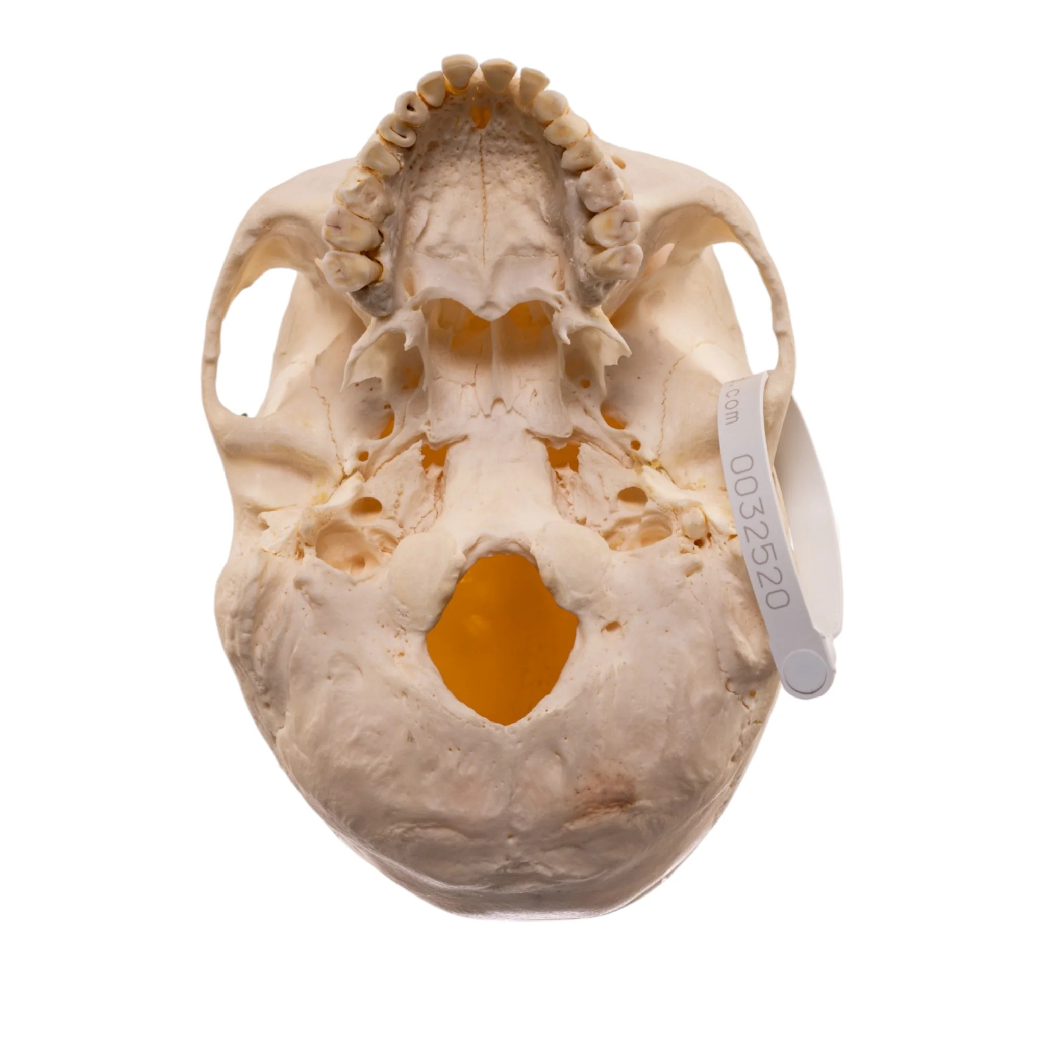 Real Human Skeleton - Disarticulated - Image 7