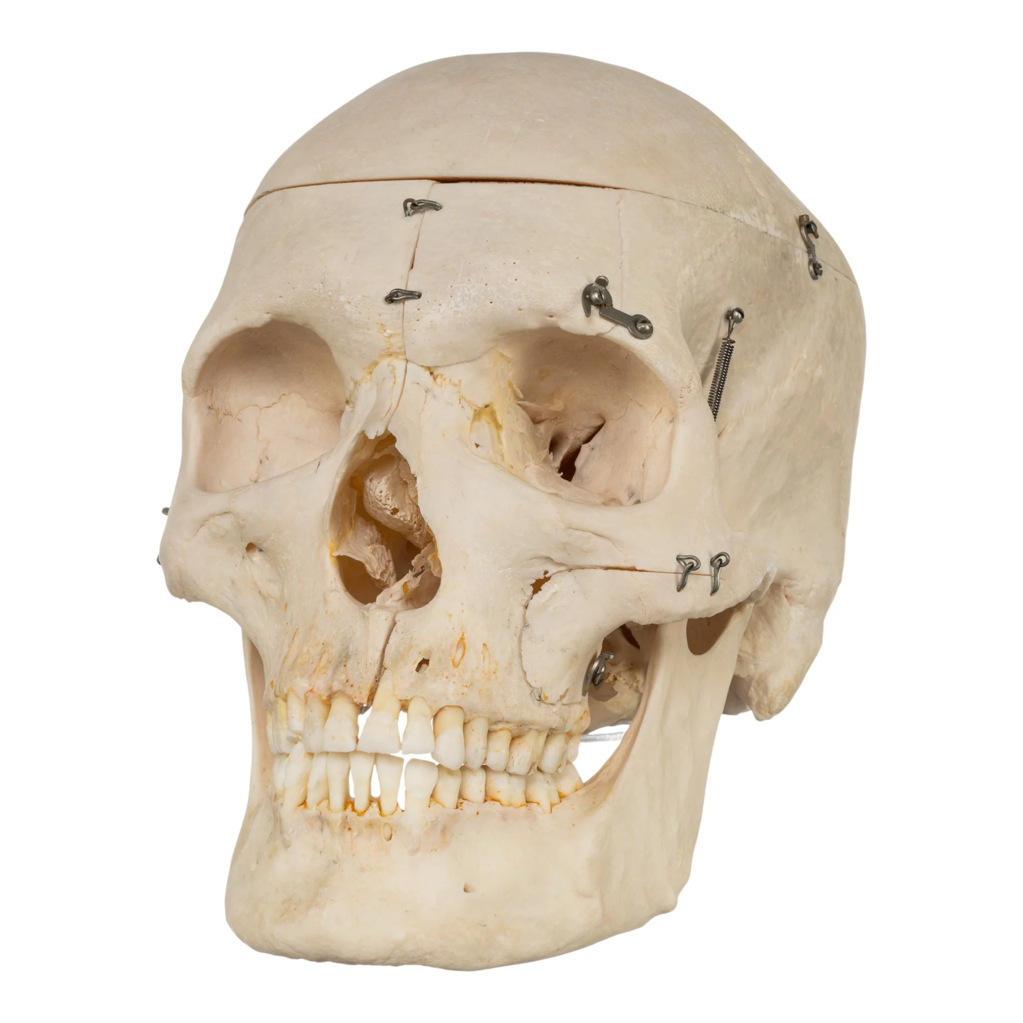 Real Human Skeleton - Disarticulated - Image 2