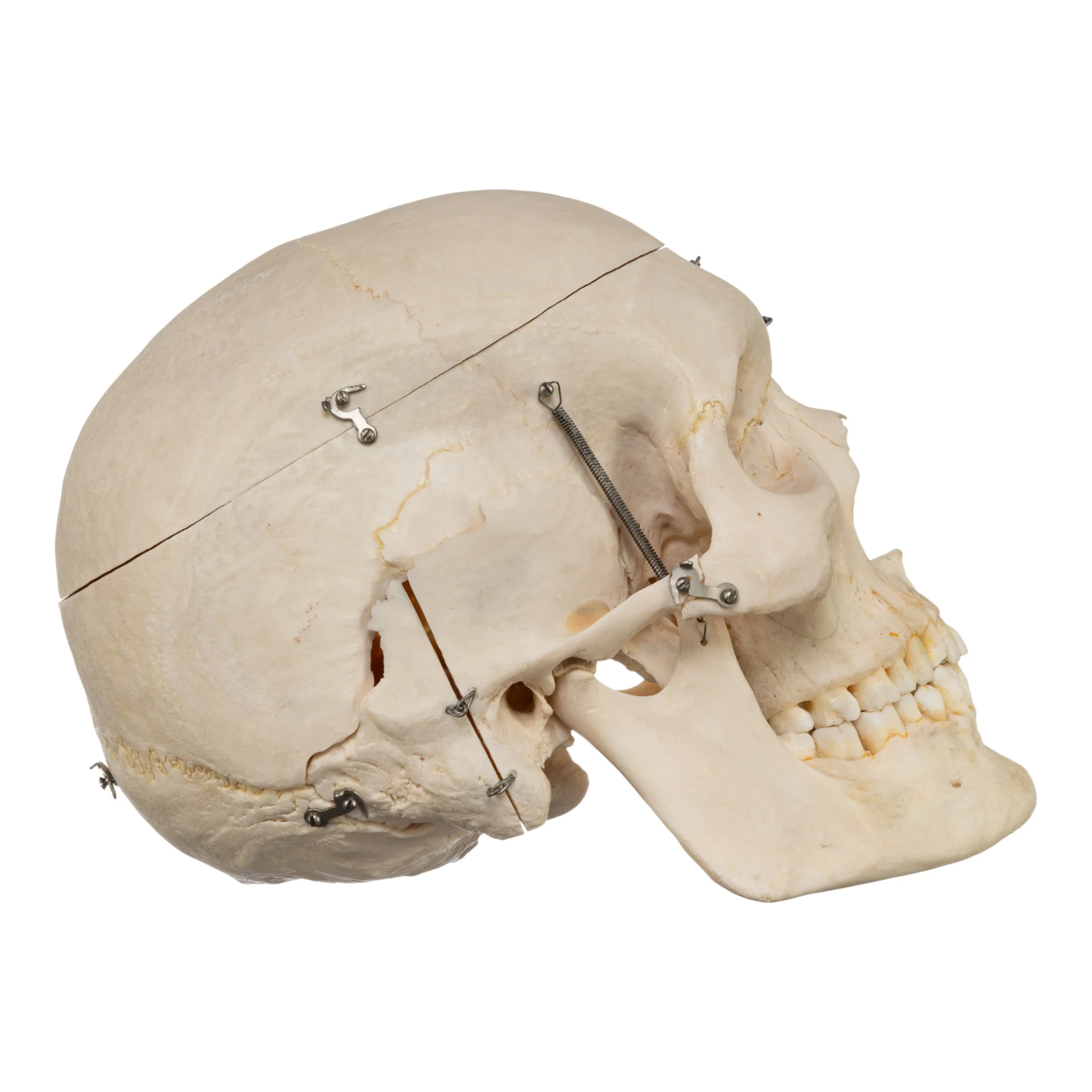 Real Human Skeleton - Disarticulated - Image 3