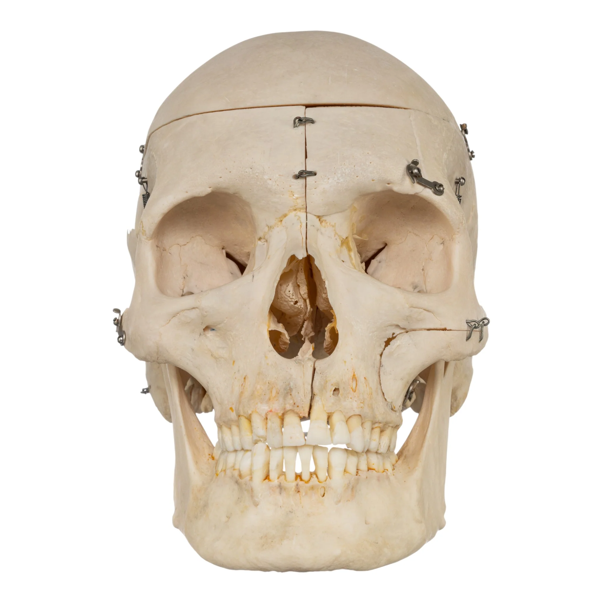 Real Human Skeleton - Disarticulated - Image 4