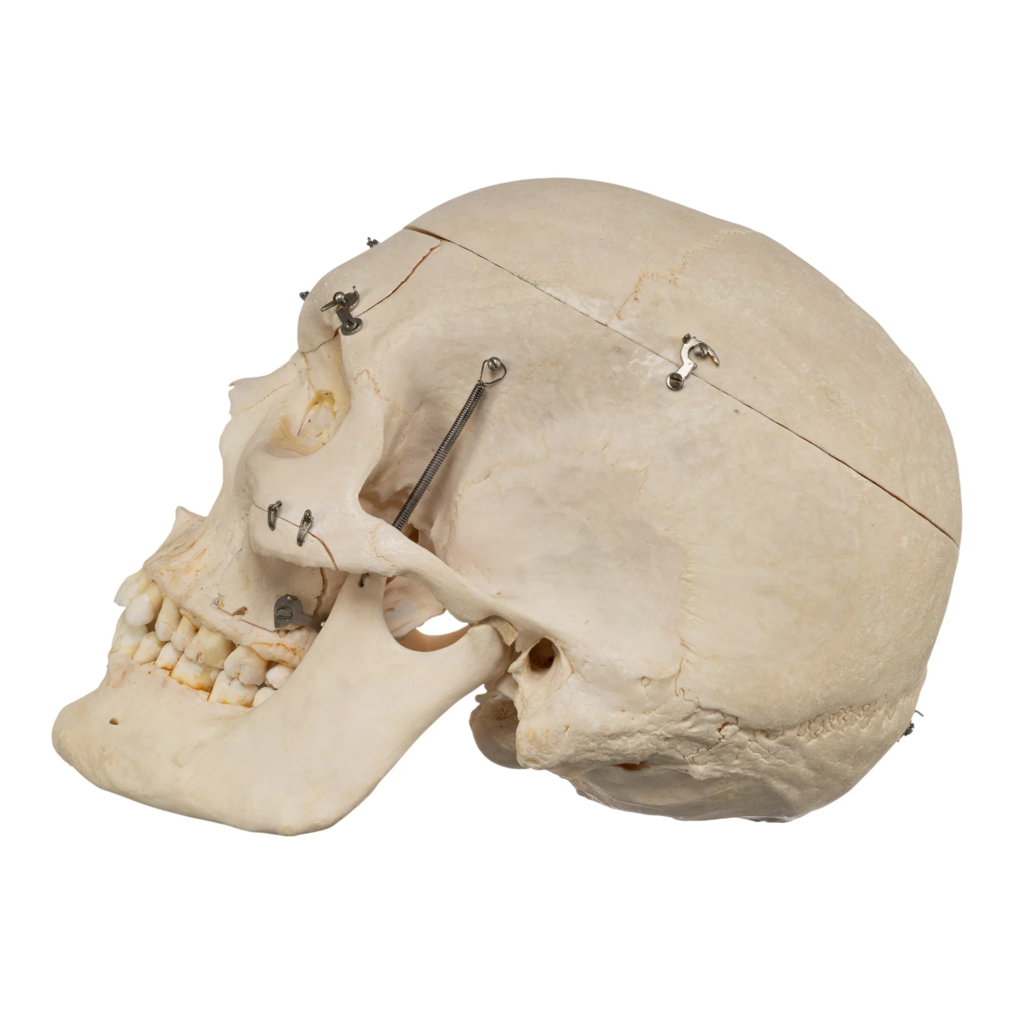 Real Human Skeleton - Disarticulated - Image 5