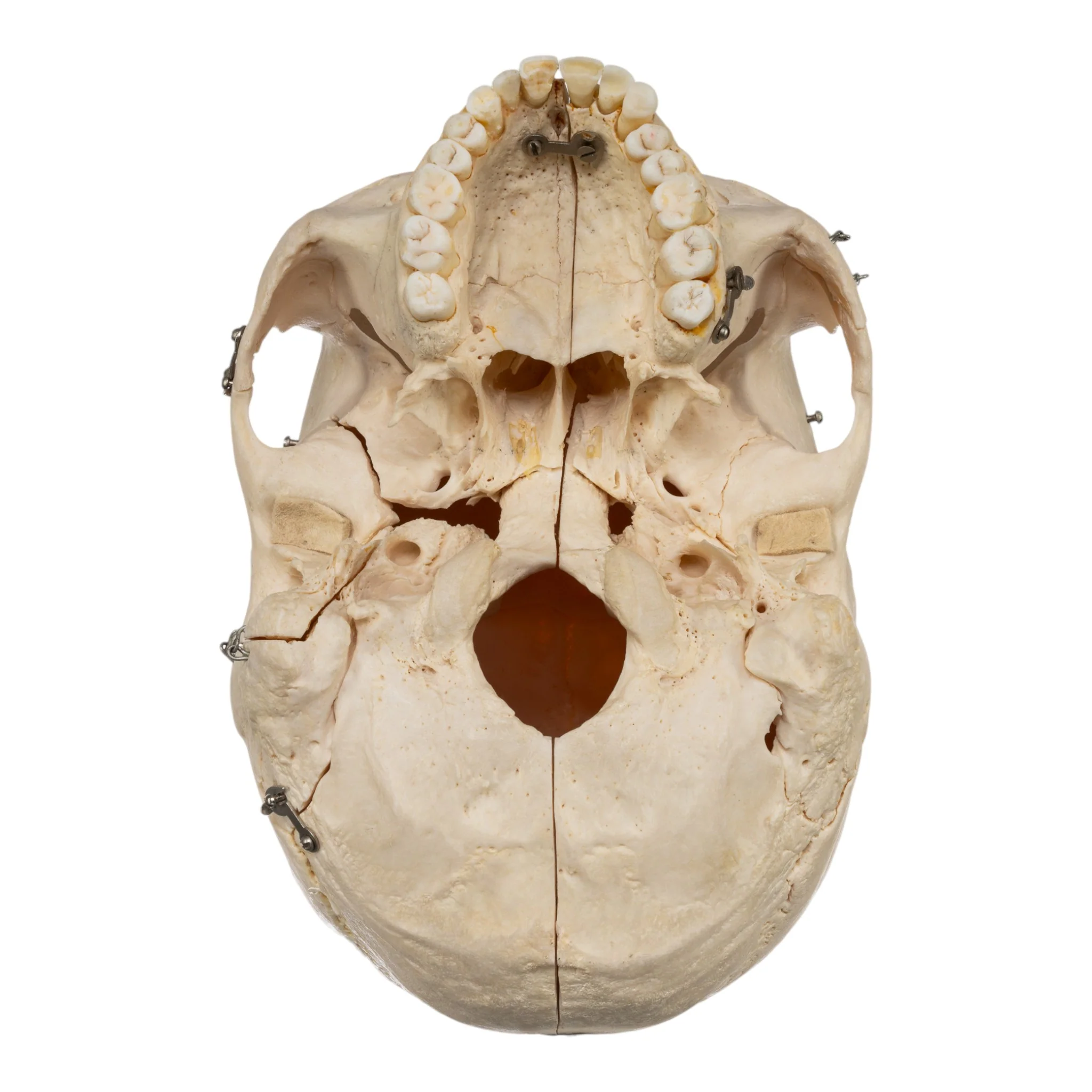 Real Human Skeleton - Disarticulated - Image 7