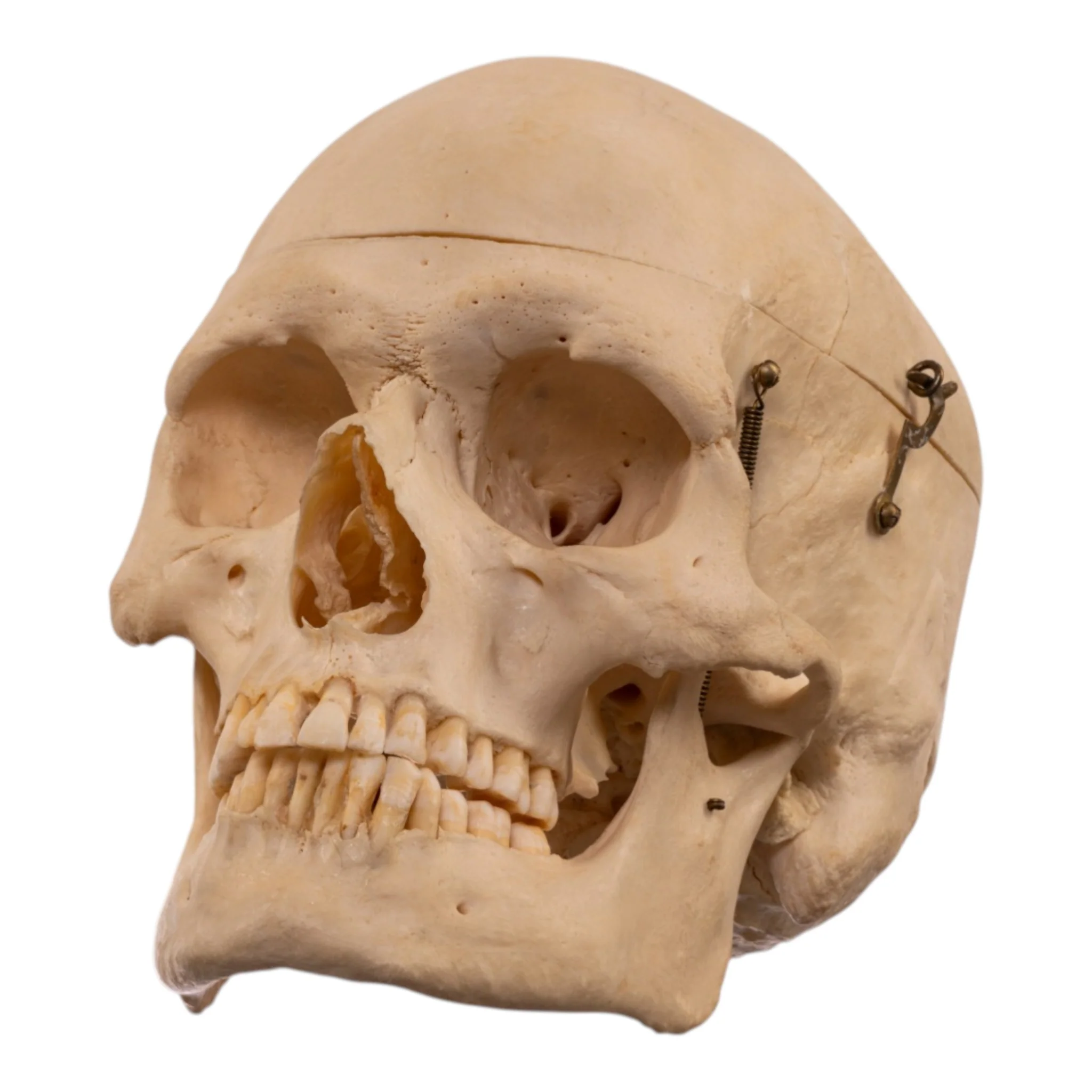 Real Human Skeleton - Disarticulated - Image 2
