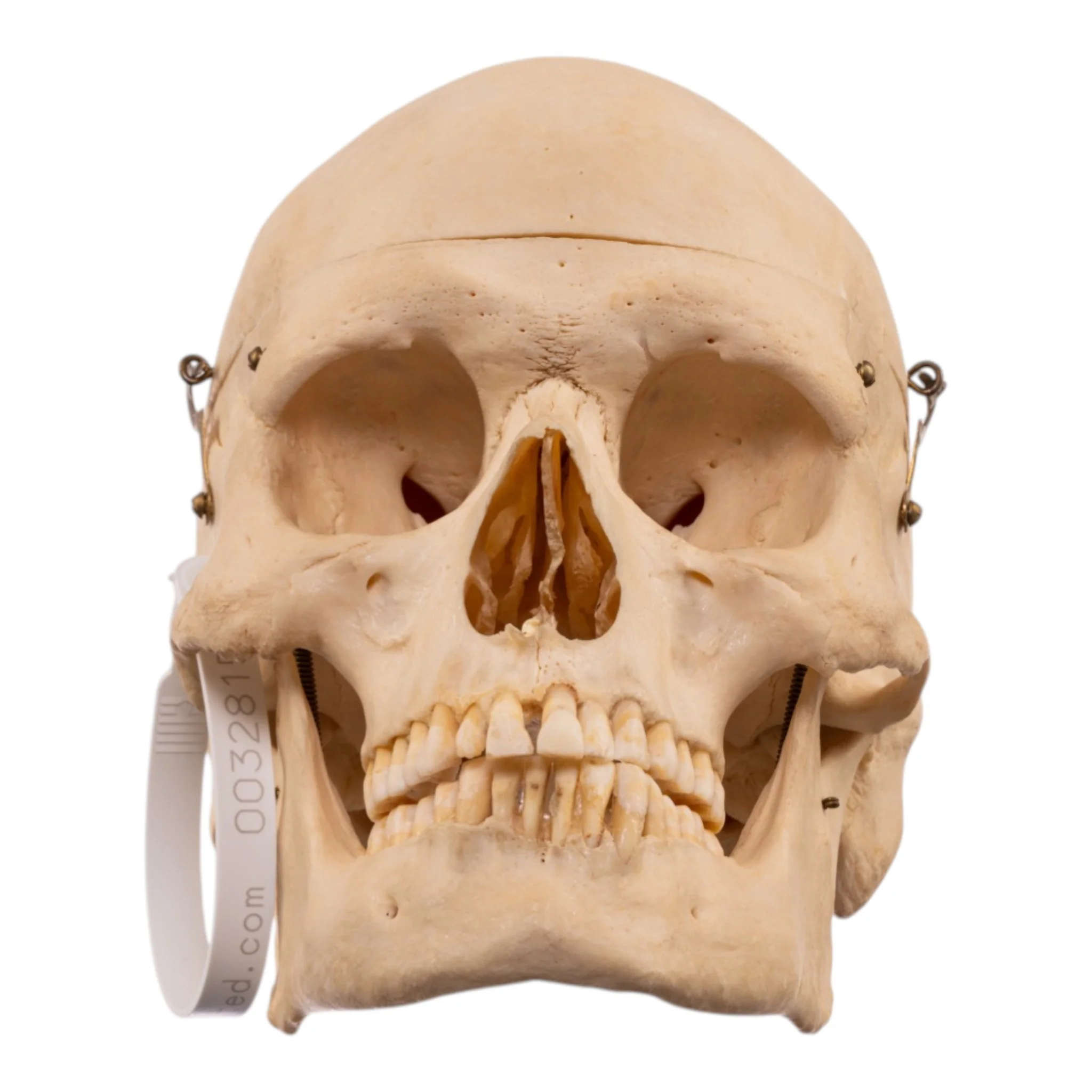 Real Human Skeleton - Disarticulated - Image 4