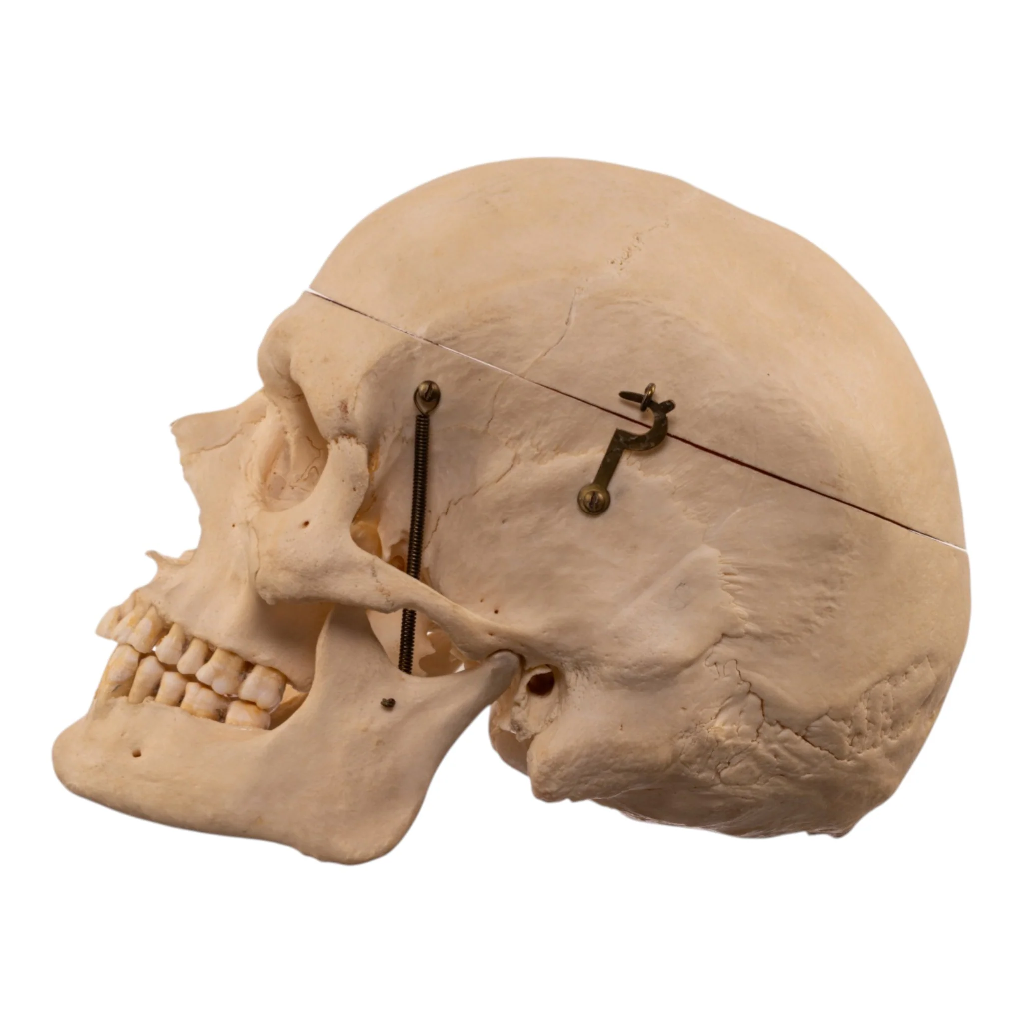 Real Human Skeleton - Disarticulated - Image 5