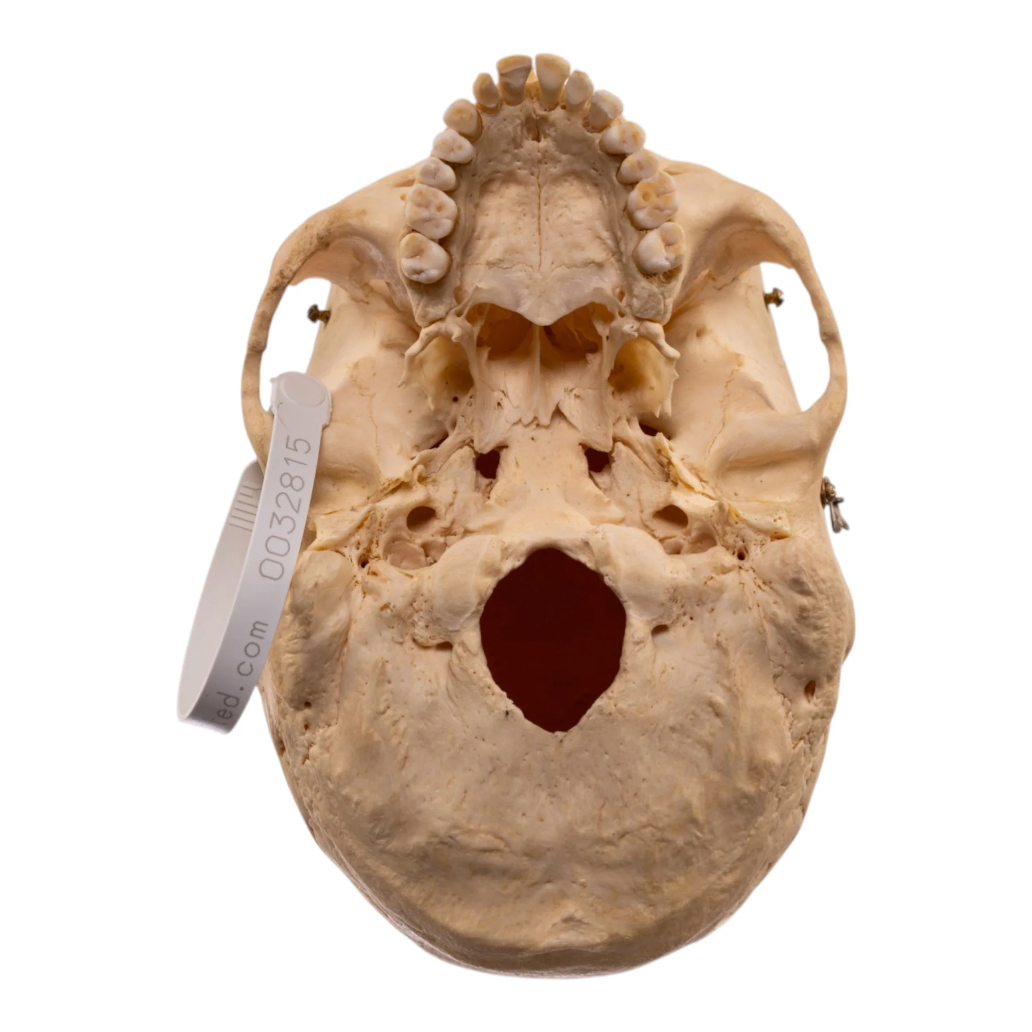 Real Human Skeleton - Disarticulated - Image 7