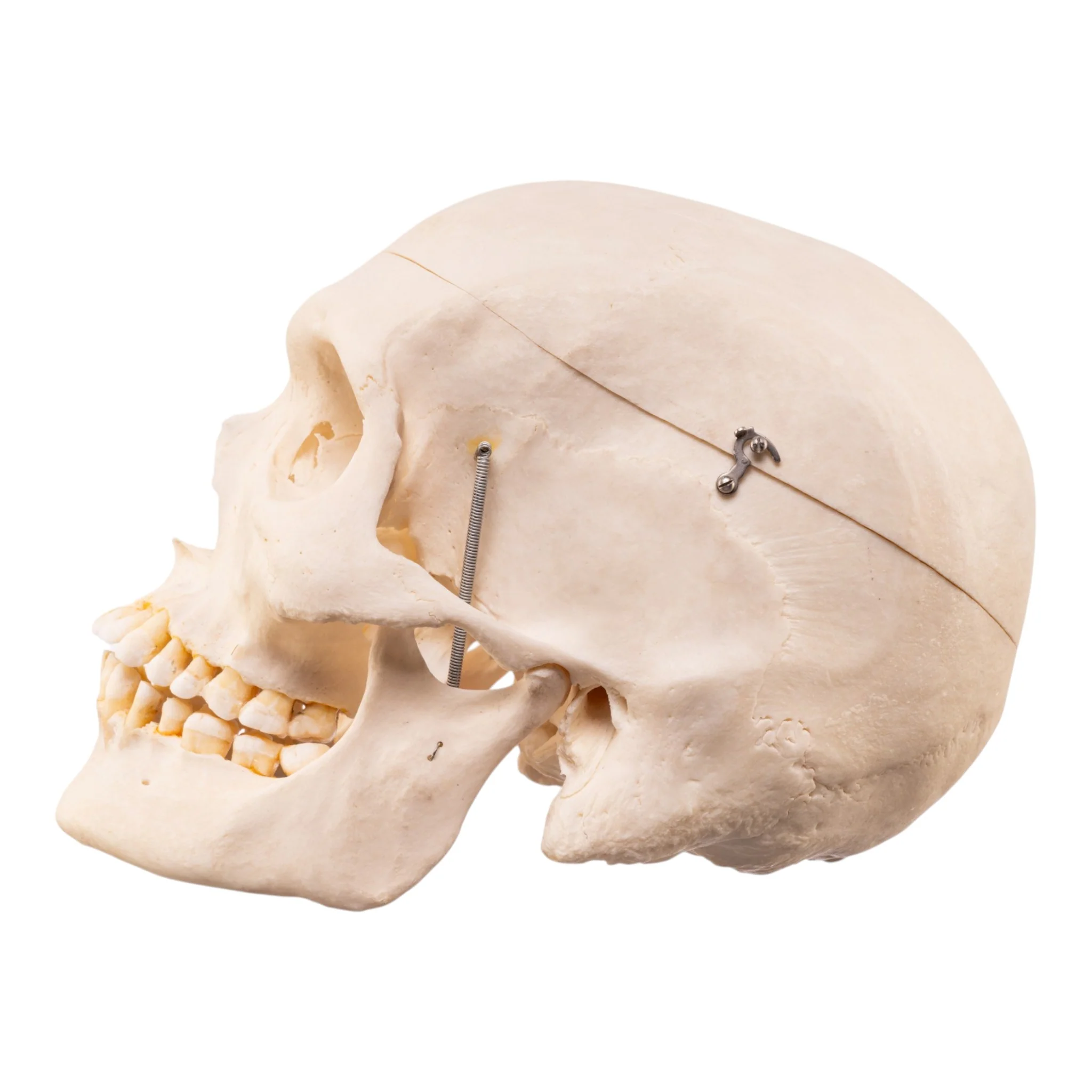 Real Human Skeleton - Disarticulated - Image 5