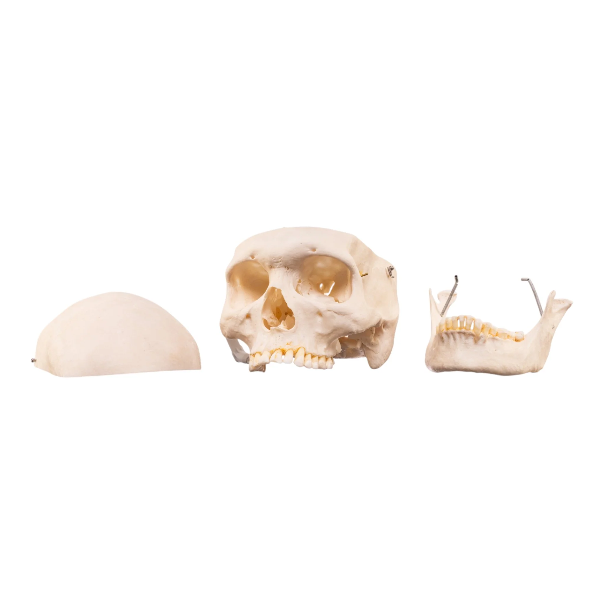 Real Human Skeleton - Disarticulated - Image 8