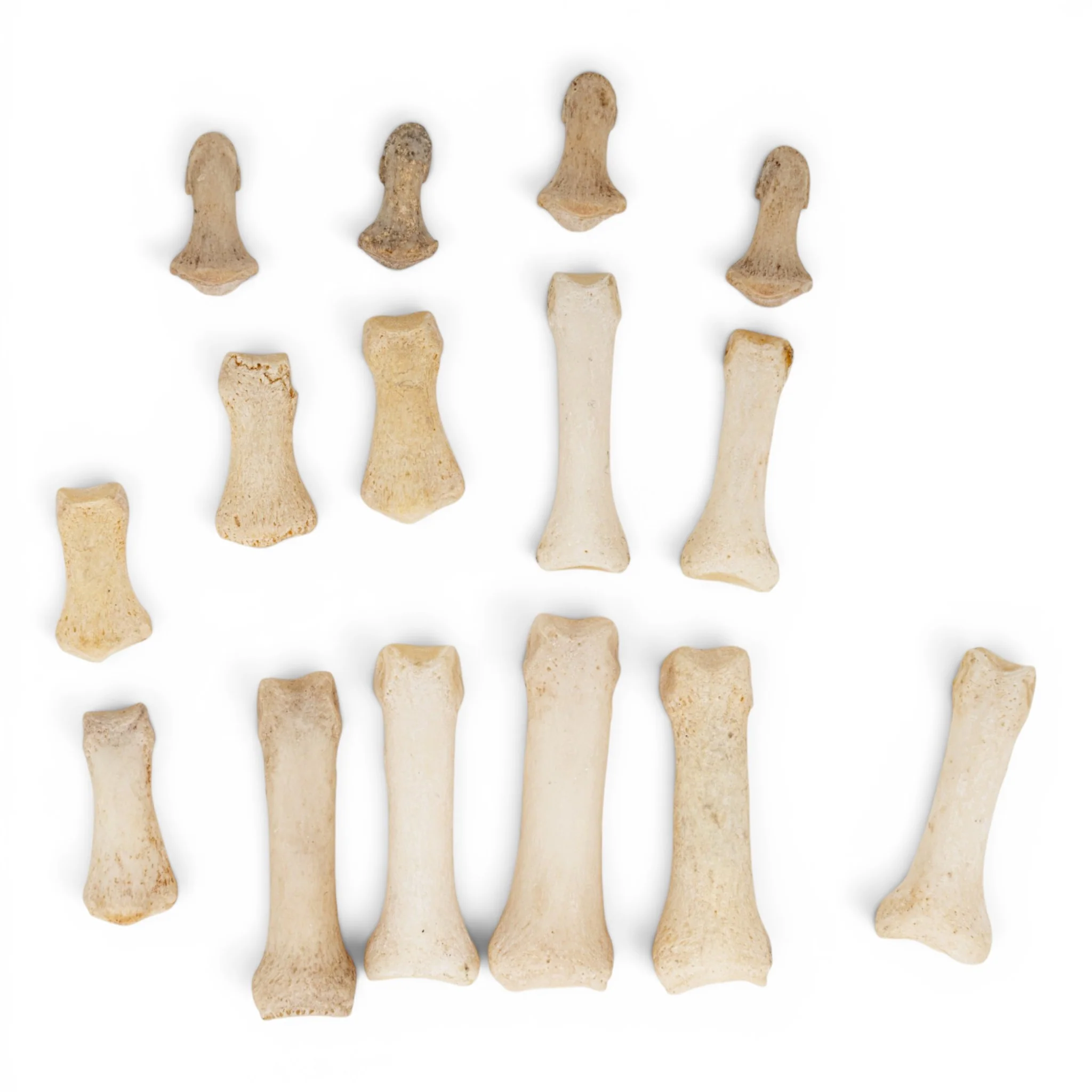 Real Human Hand - Partial - Disarticulated
