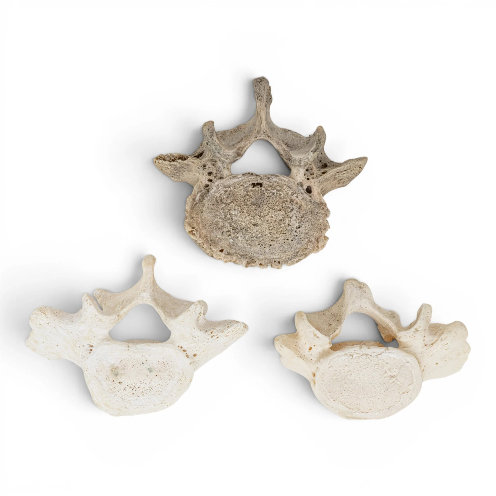 Real Human Lumbar Vertebrae - Image 2