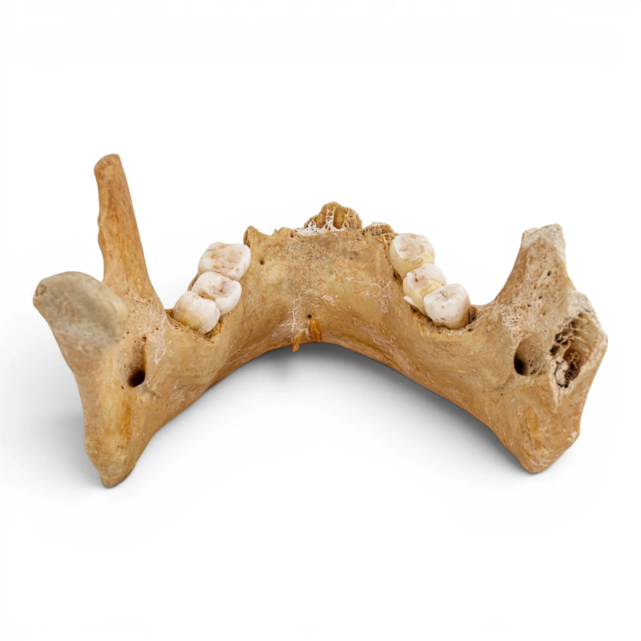 Real Human Mandible - Antique - Image 5