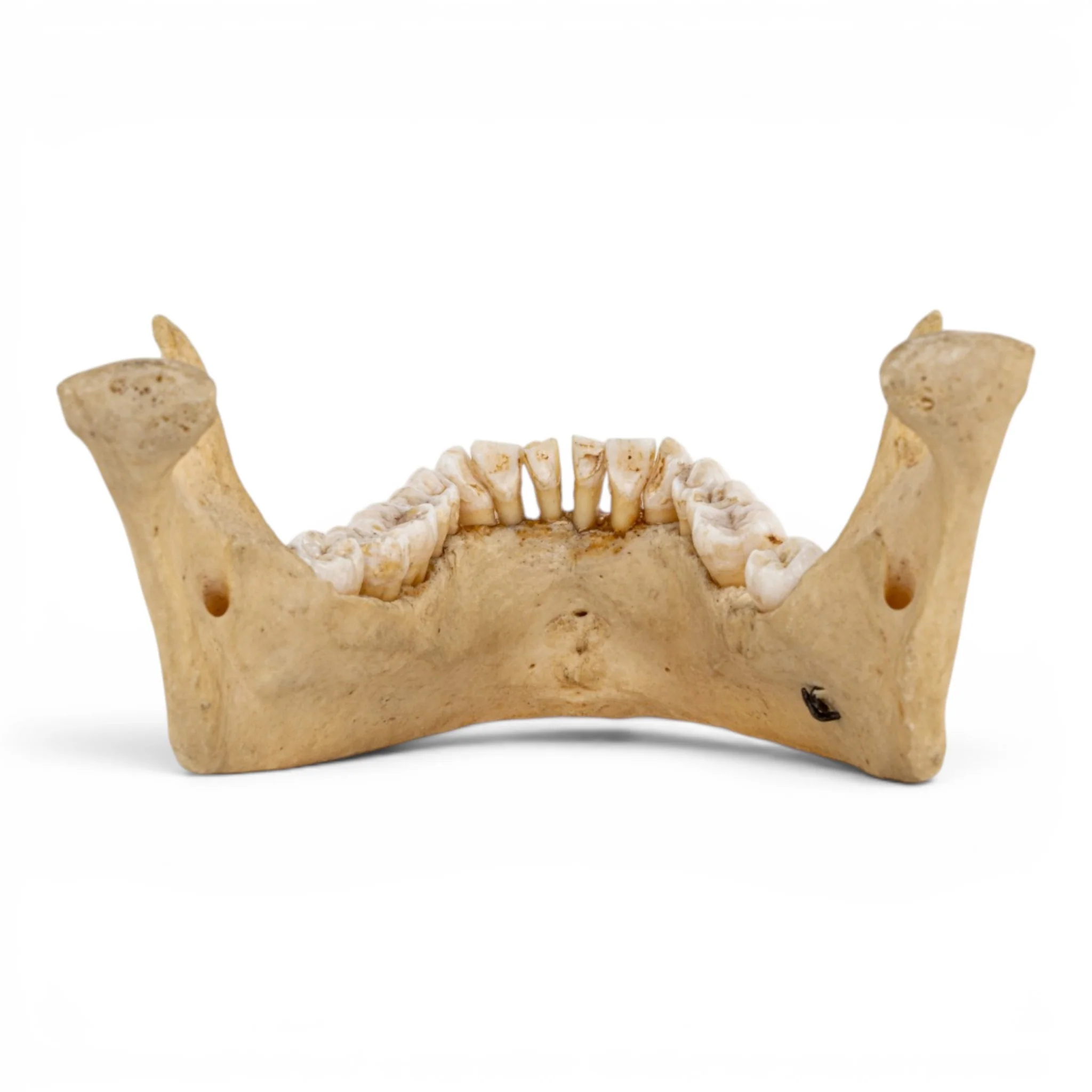 Real Human Mandible - Dissected - Image 5