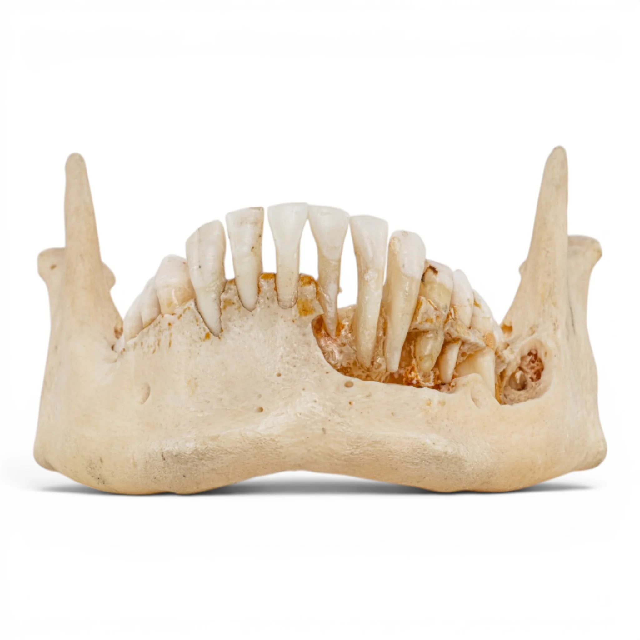 Real Human Mandible - Dissected - Image 3