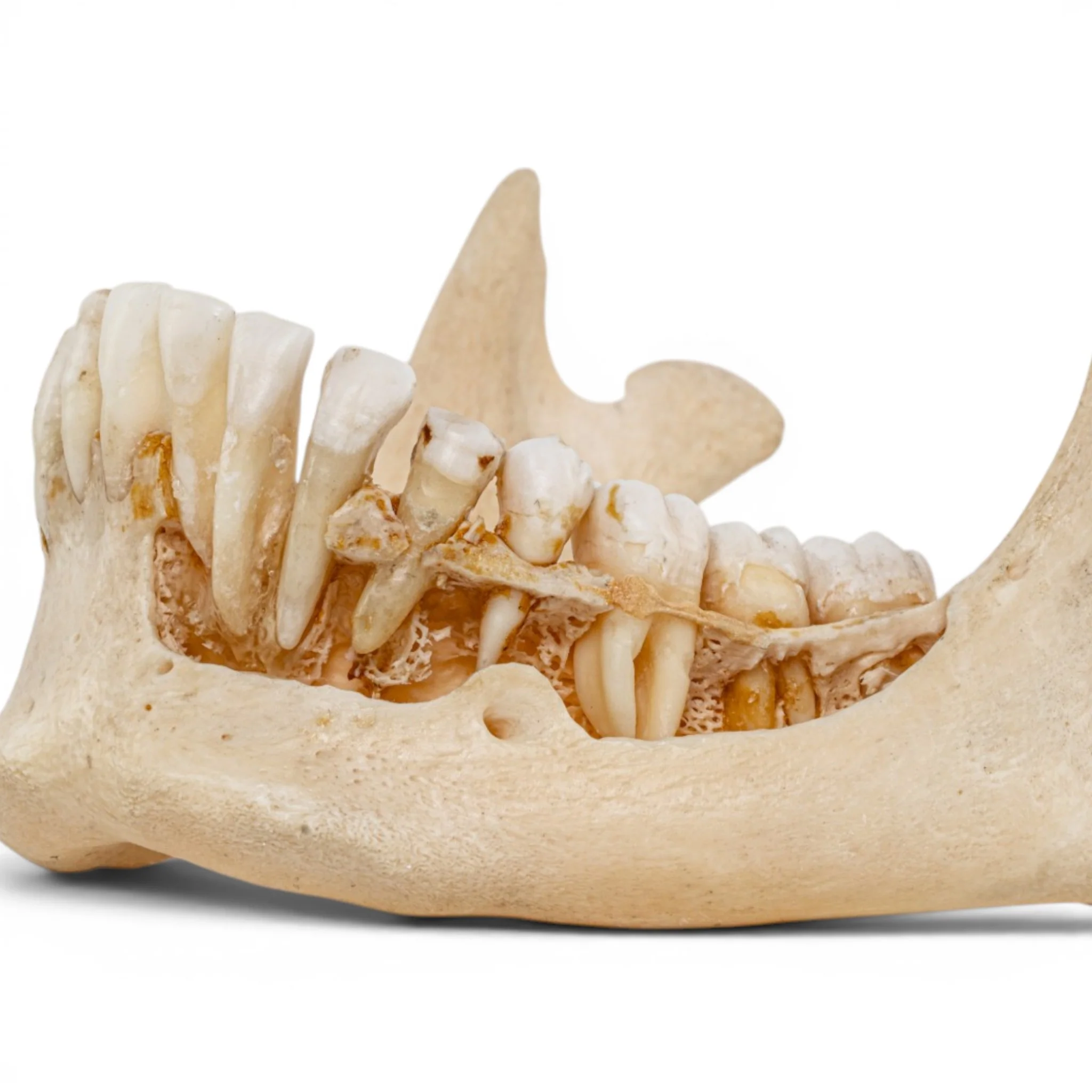 Real Human Mandible - Dissected - Image 6