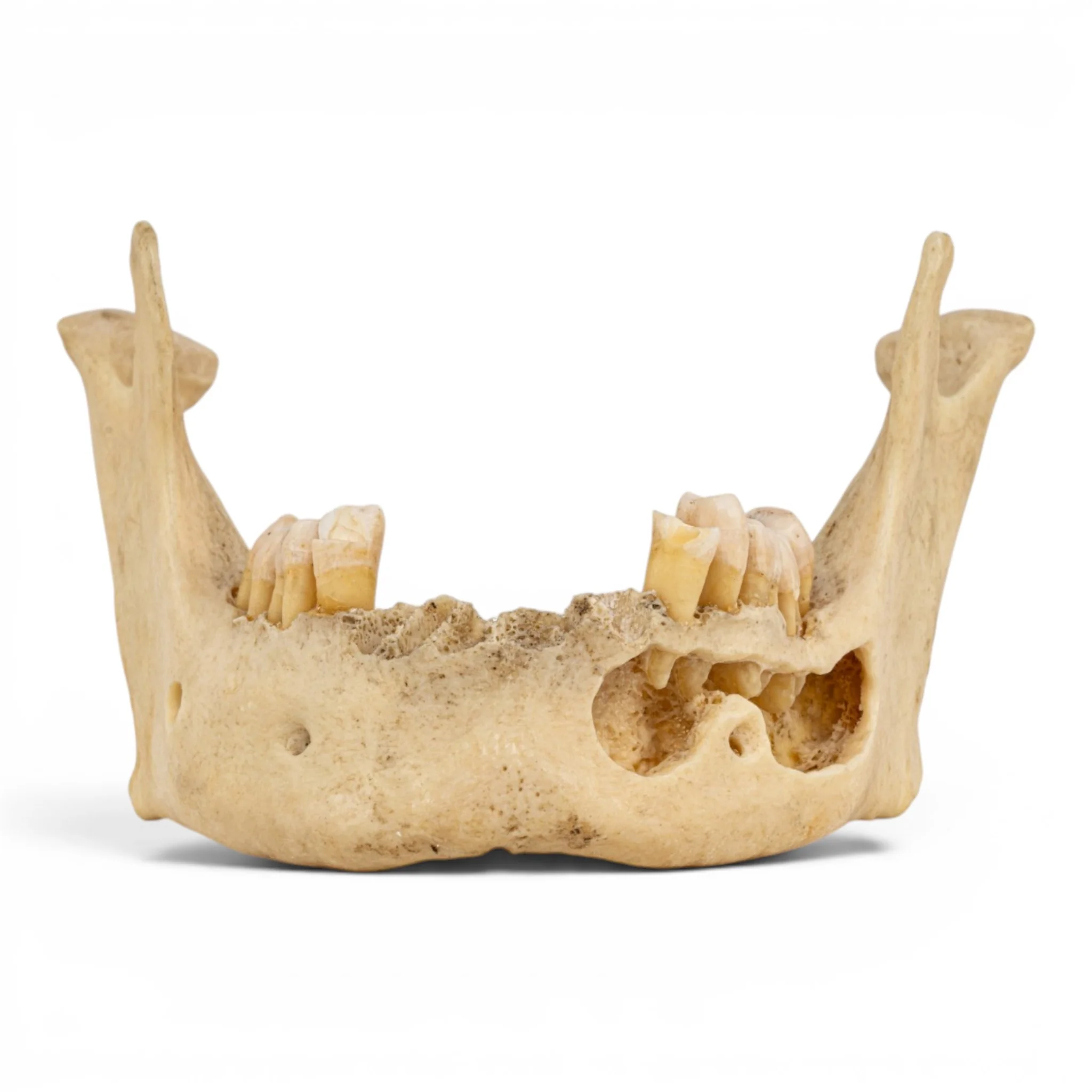 Real Human Mandible - Dissected - Image 3