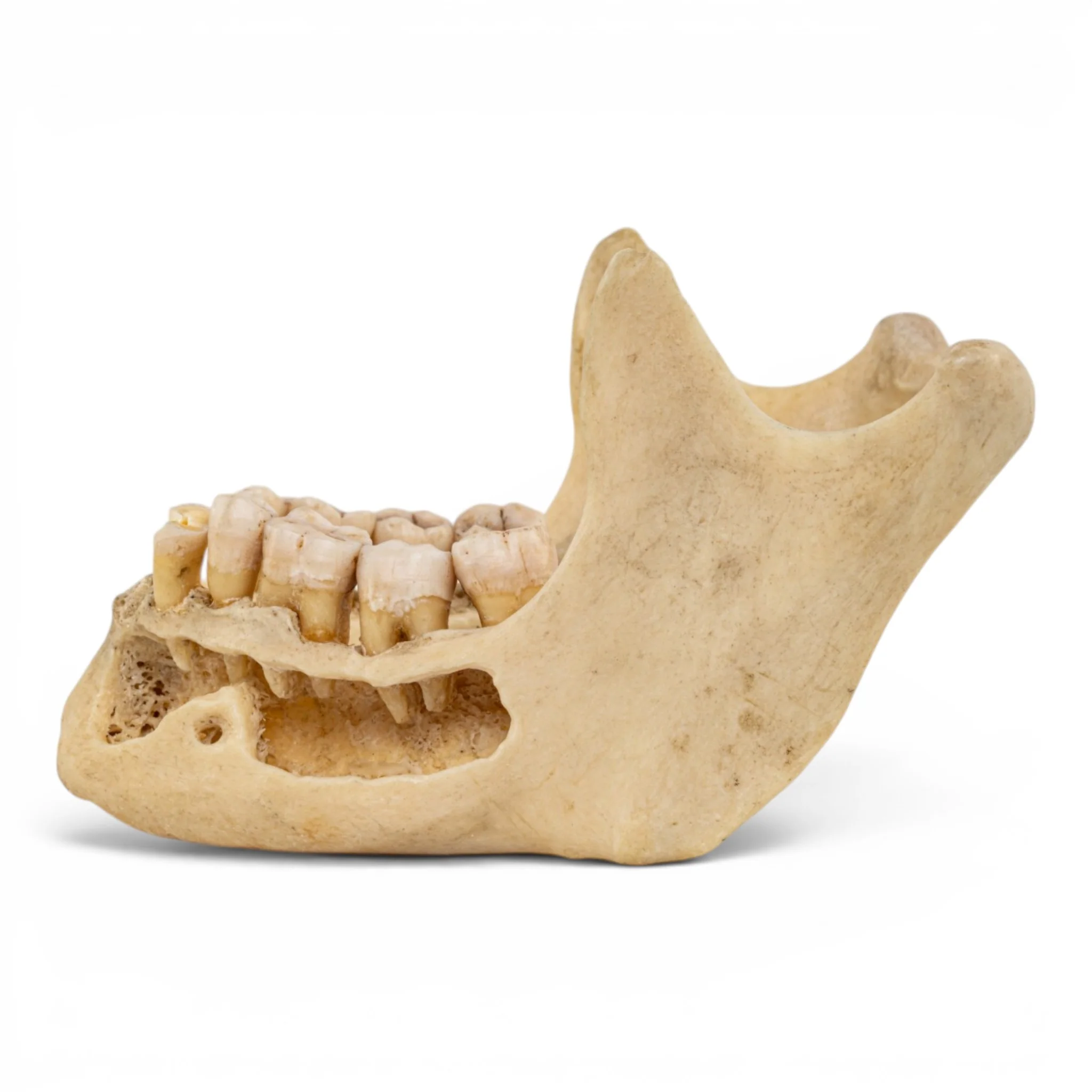 Real Human Mandible - Dissected - Image 4
