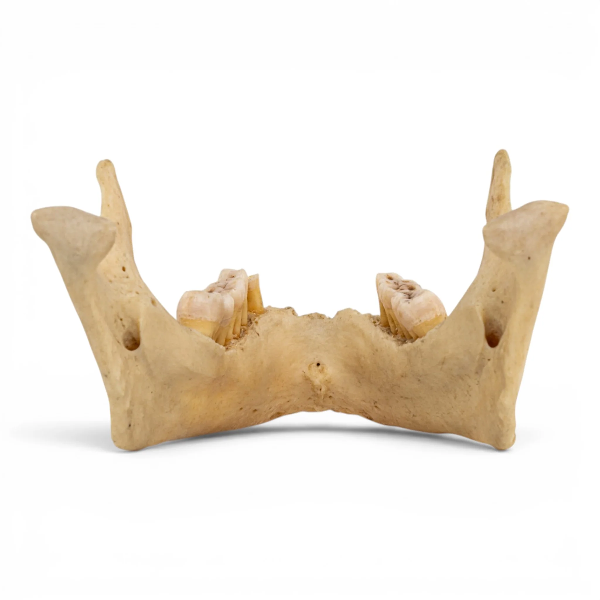 Real Human Mandible - Dissected - Image 5