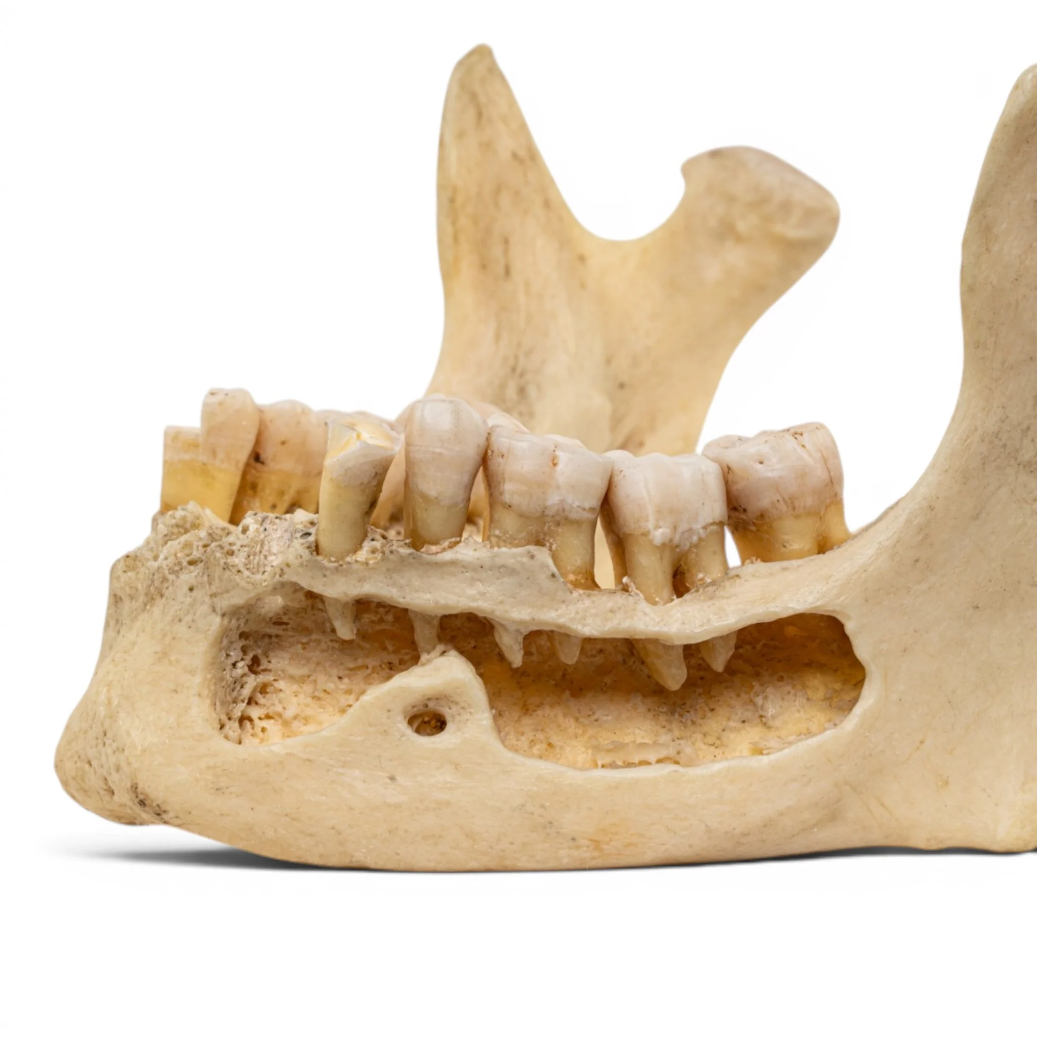 Real Human Mandible - Dissected - Image 6