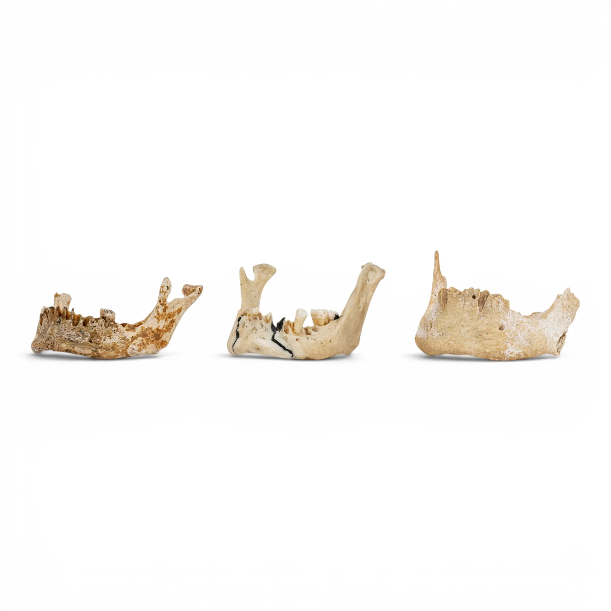Real Human Mandible - Set of 3