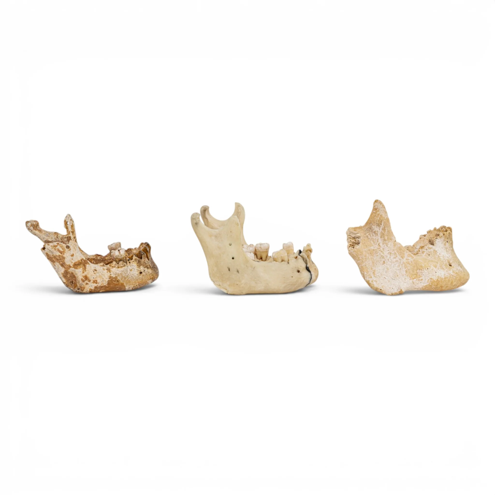 Real Human Mandible - Set of 3 - Image 2