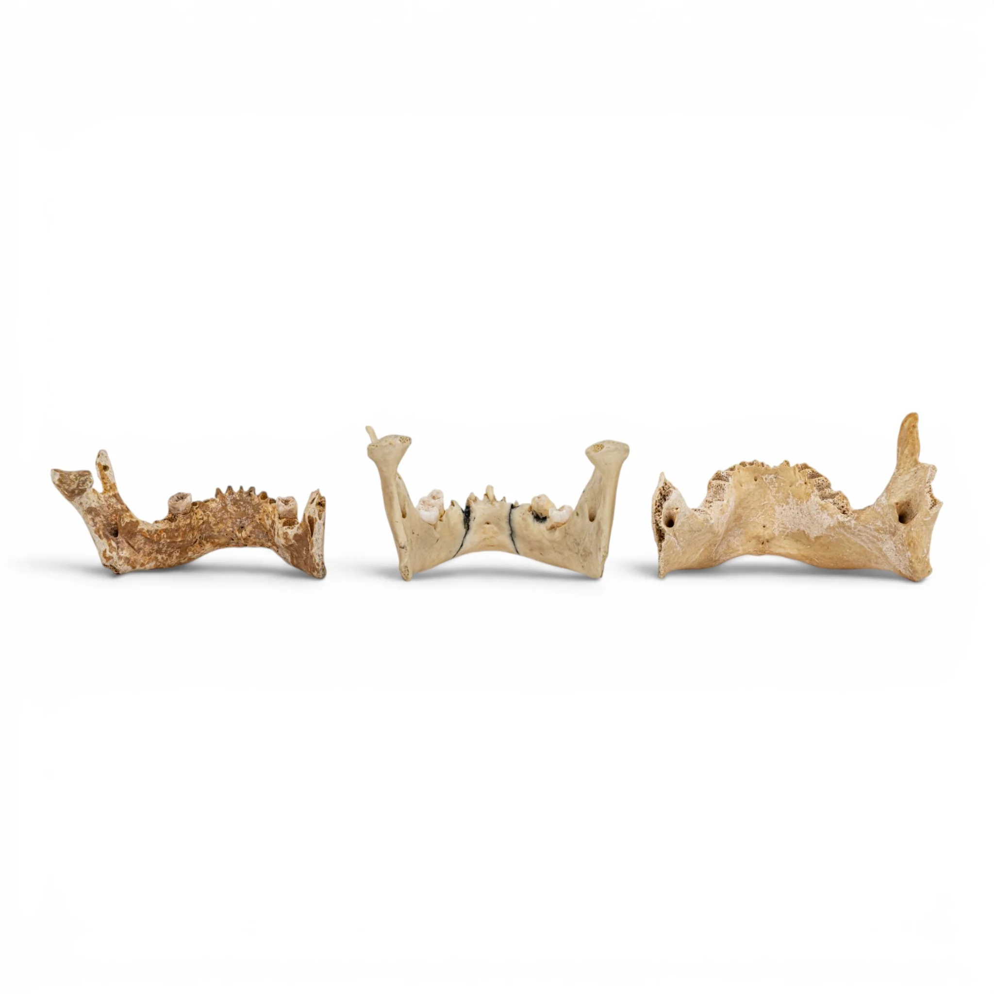 Real Human Mandible - Set of 3 - Image 5