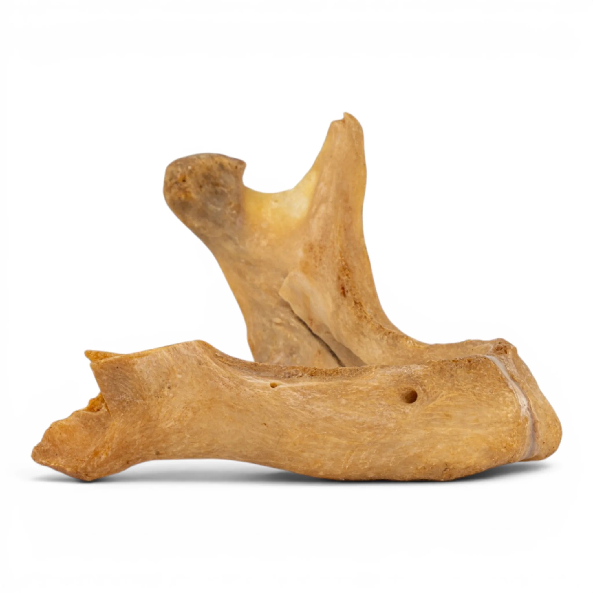 Real Human Mandible - Pathology - Set of 3 - Image 8