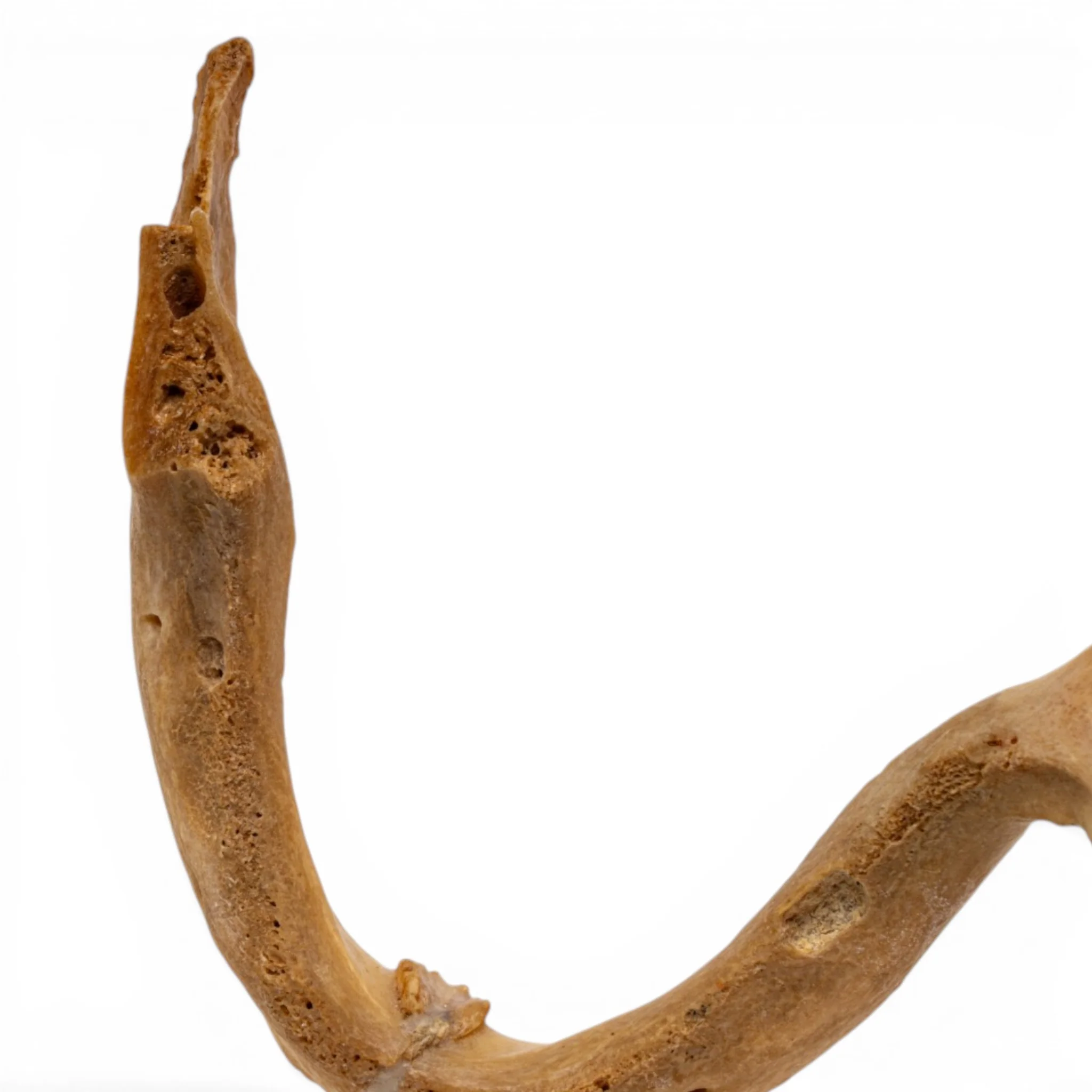 Real Human Mandible - Pathology - Set of 3 - Image 9