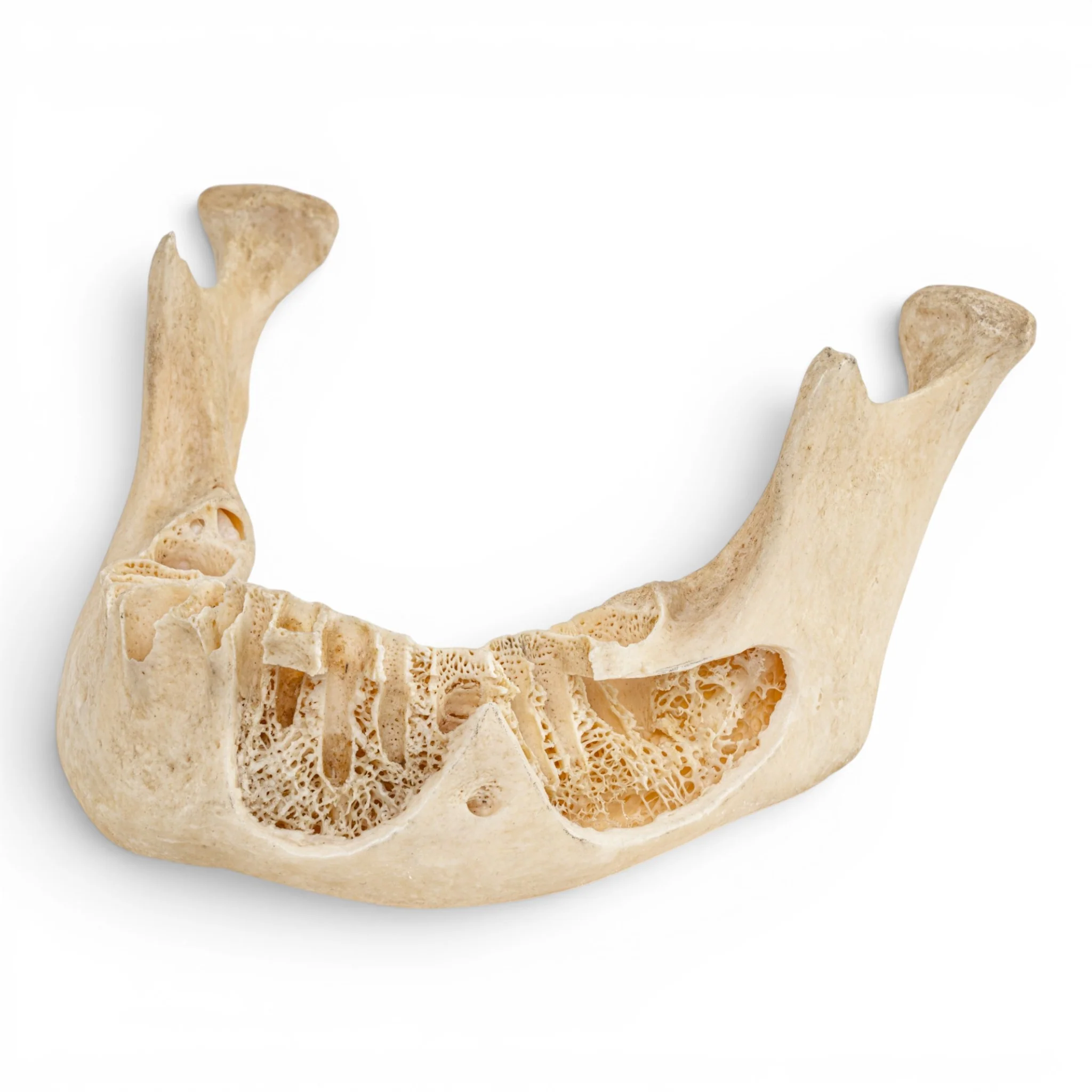 Real Human Mandible - Dissected