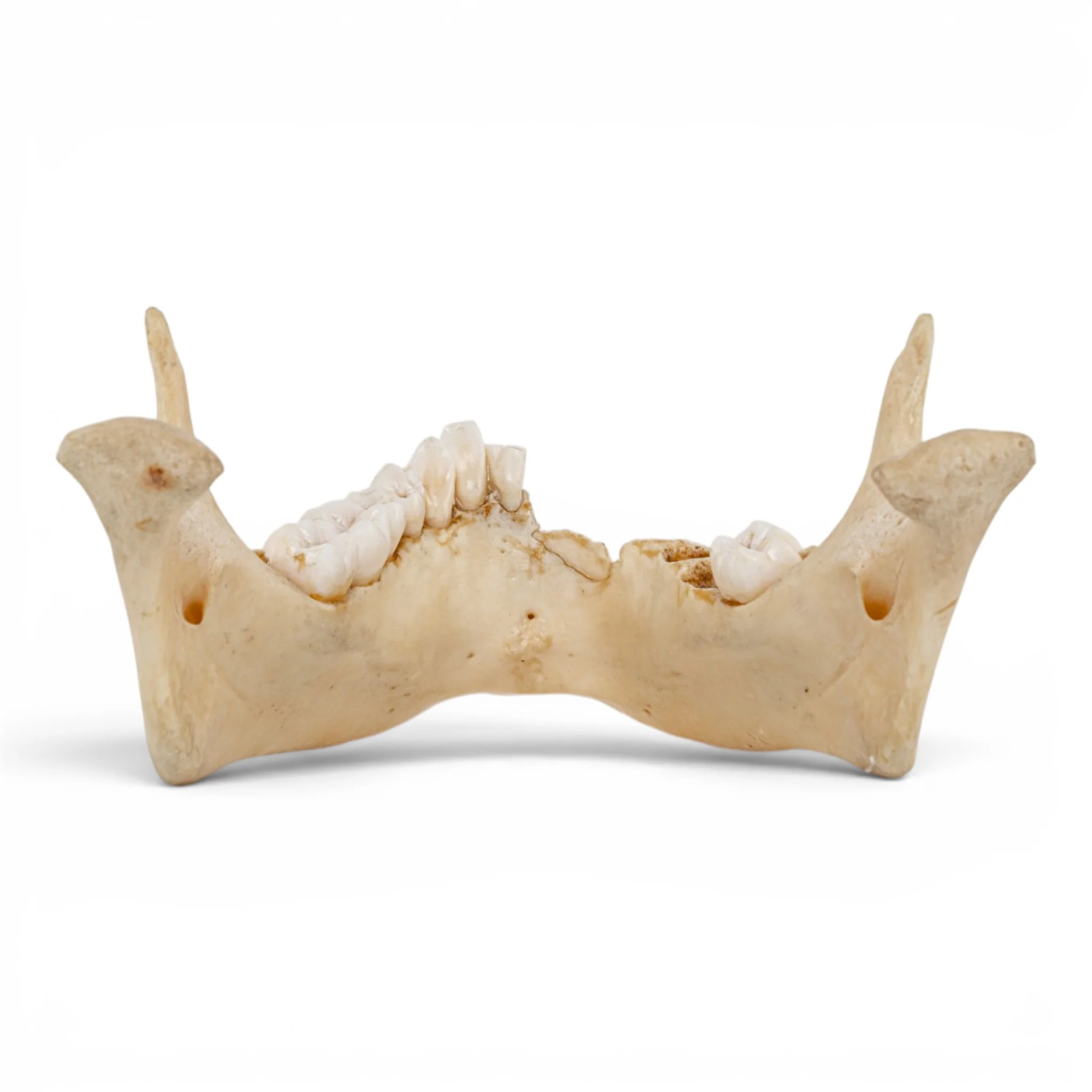 Real Human Mandible - Dissected - Image 5
